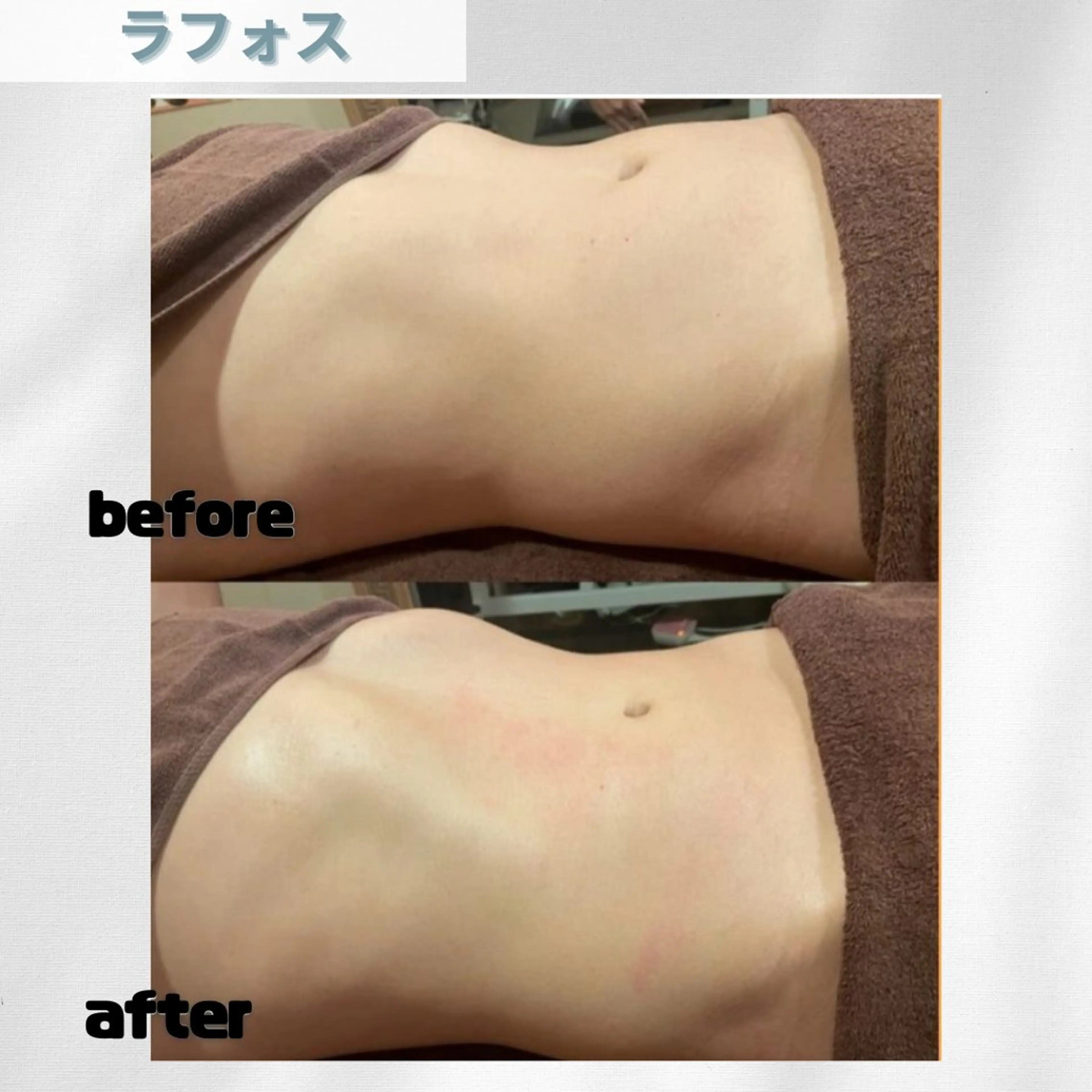 エステ リラク 🫧ビュースタ 伊藤🫧のエステ・リラクイメージ
