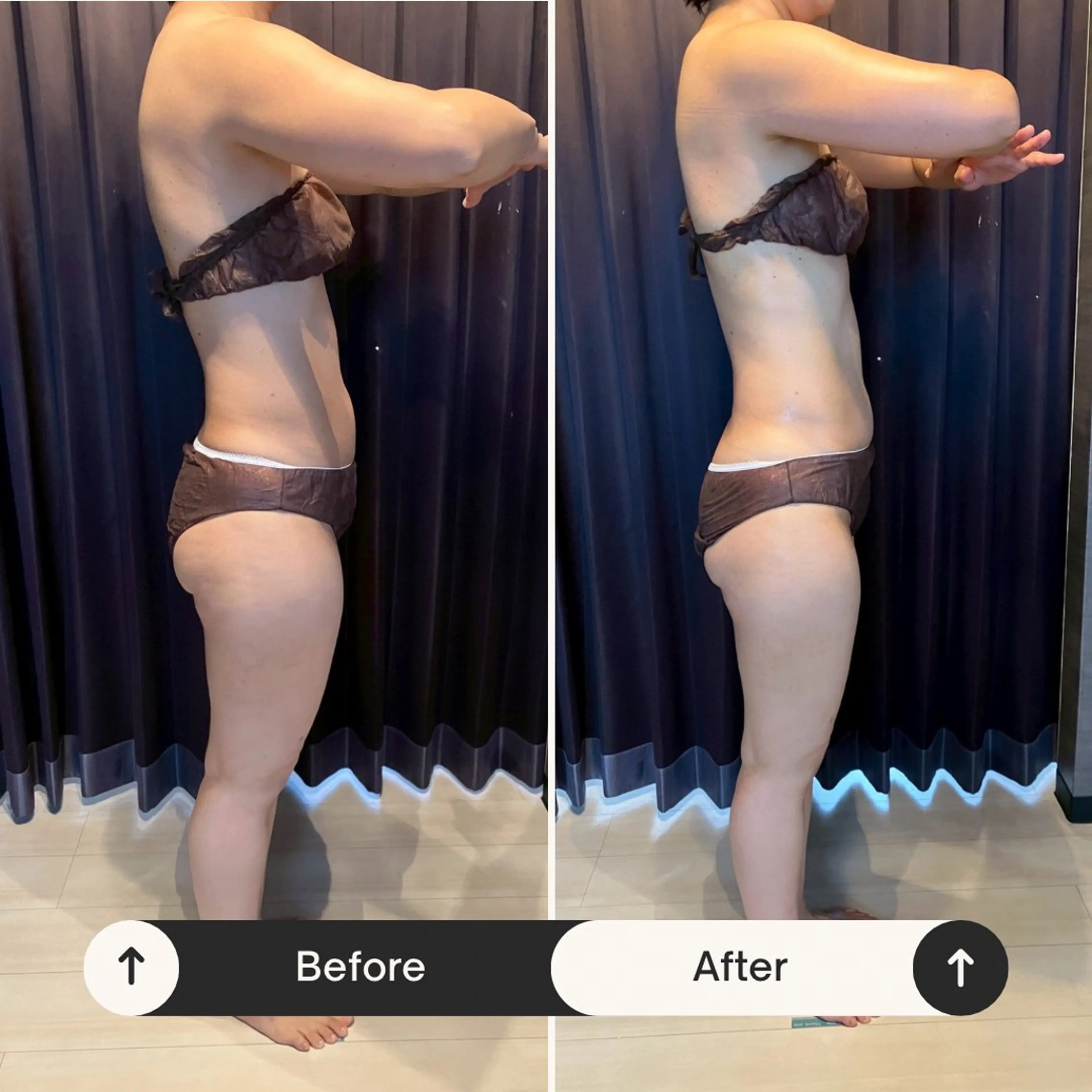 ◎やっぱりコレが1番人気【80分美姿勢整体×凸凹セルライトゼロエステ】の写真