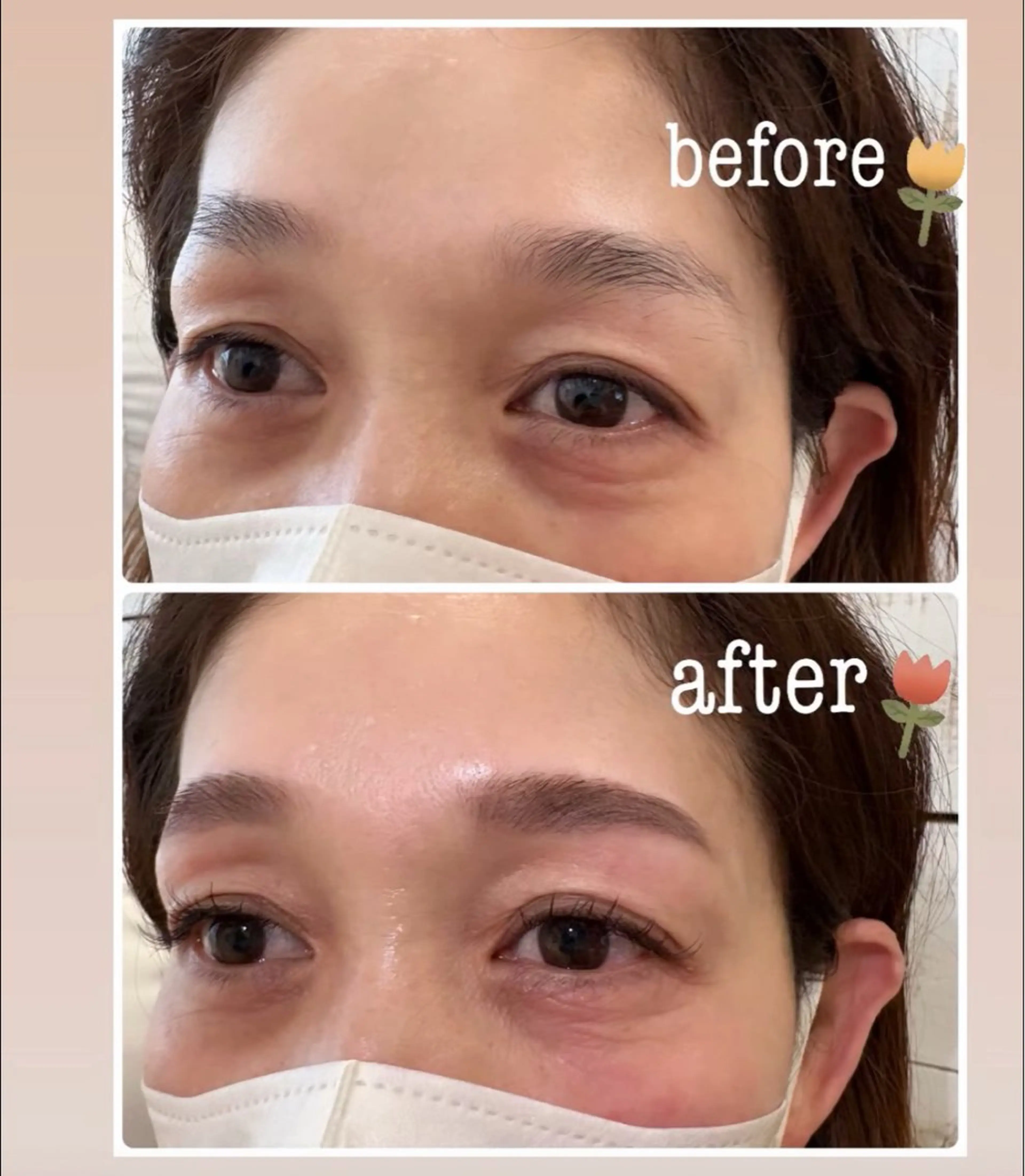 アイブロウ 眉毛ワックス脱毛 ワックス脱毛 その他(アイブロウ) mist AYA 🏝️eyelashのマツエク・マツパデザイン