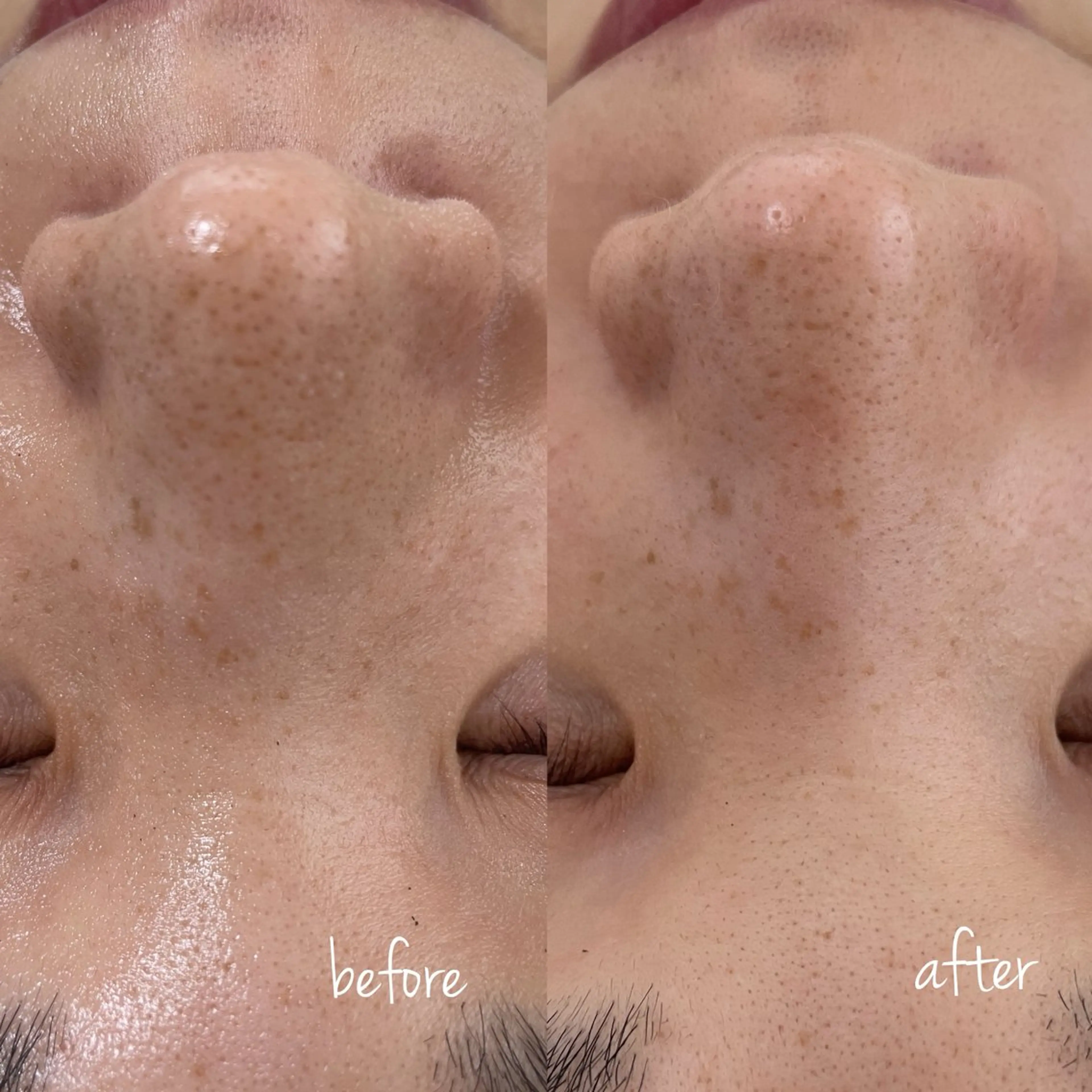 エステ Eve [nail ＊wax＊HBL]のネイルデザイン