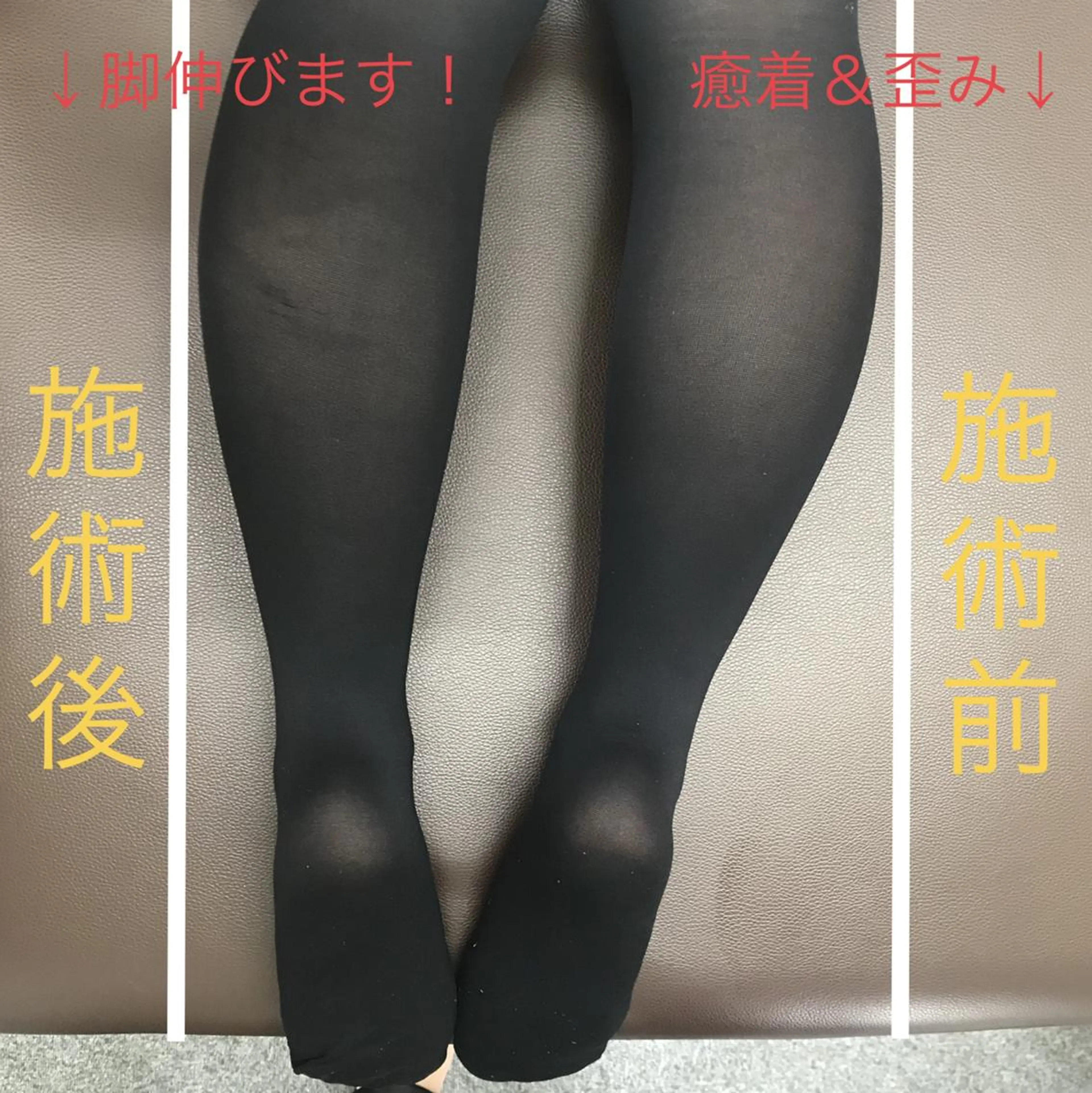 🗻エステティック RAYVIS藤🐈のエステ・リラクイメージ