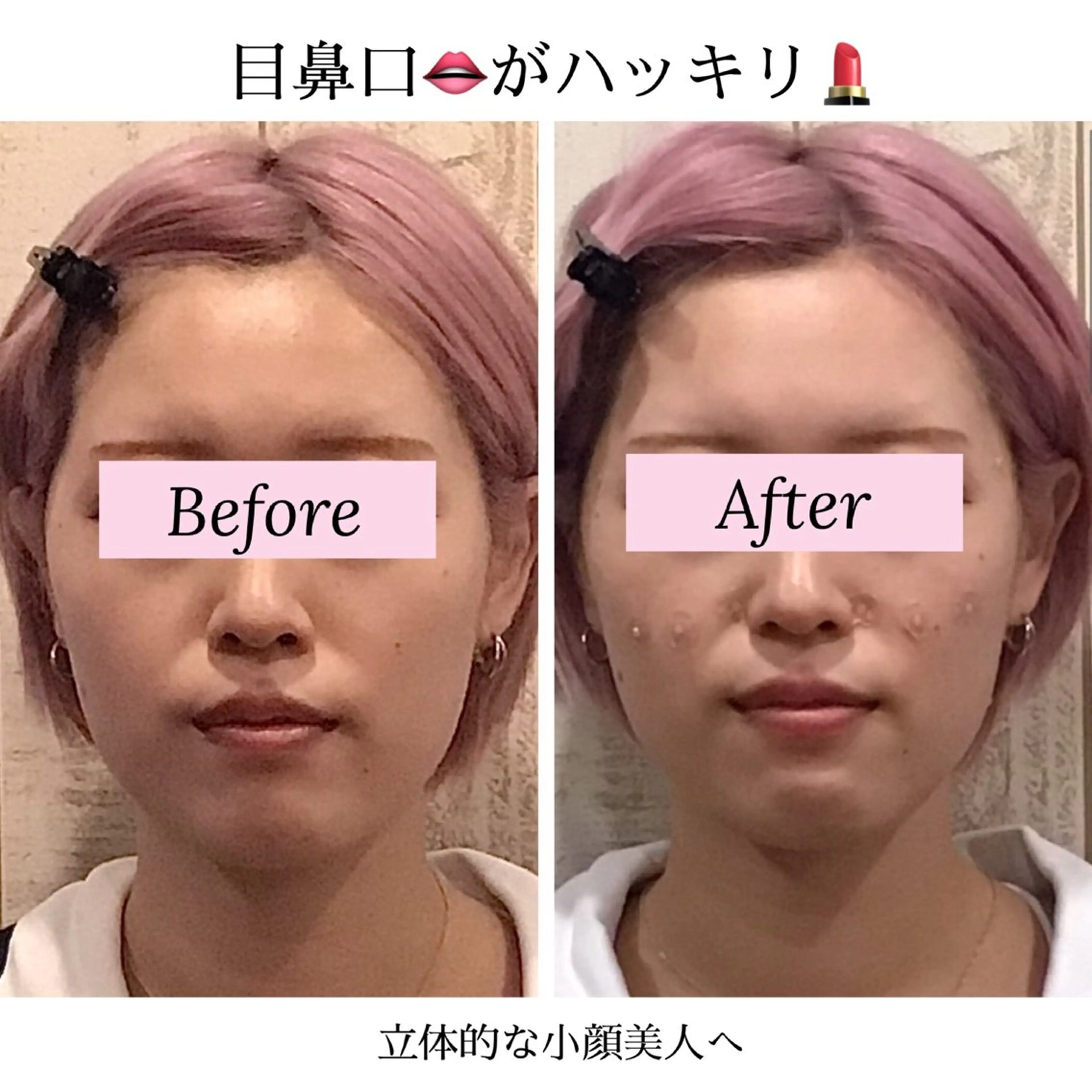 小顔専門☠️ 筋膜/脂肪/毛穴洗浄のエステ・リラクイメージ