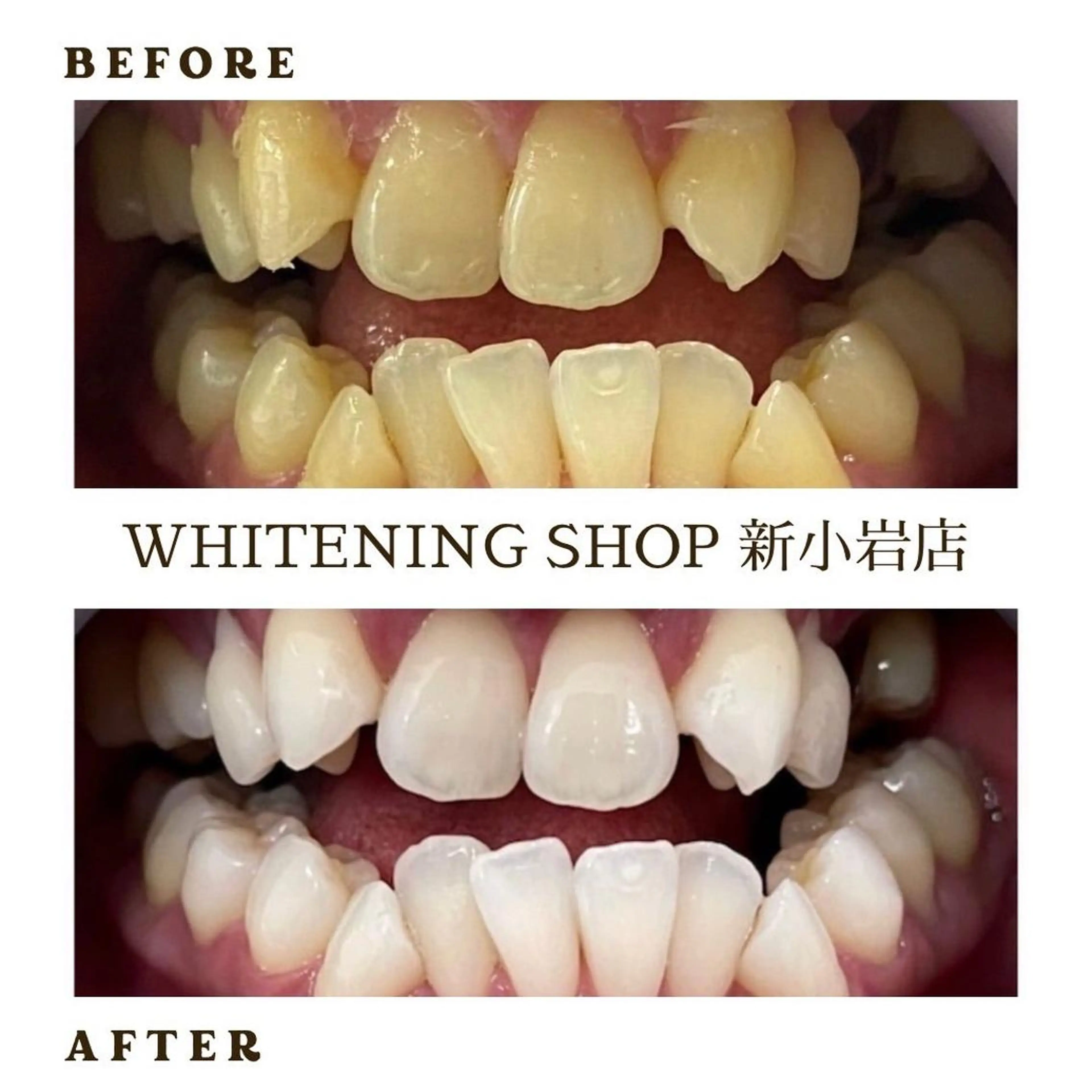 メンズ その他 ホワイトニング ショップ新小岩店のその他イメージ