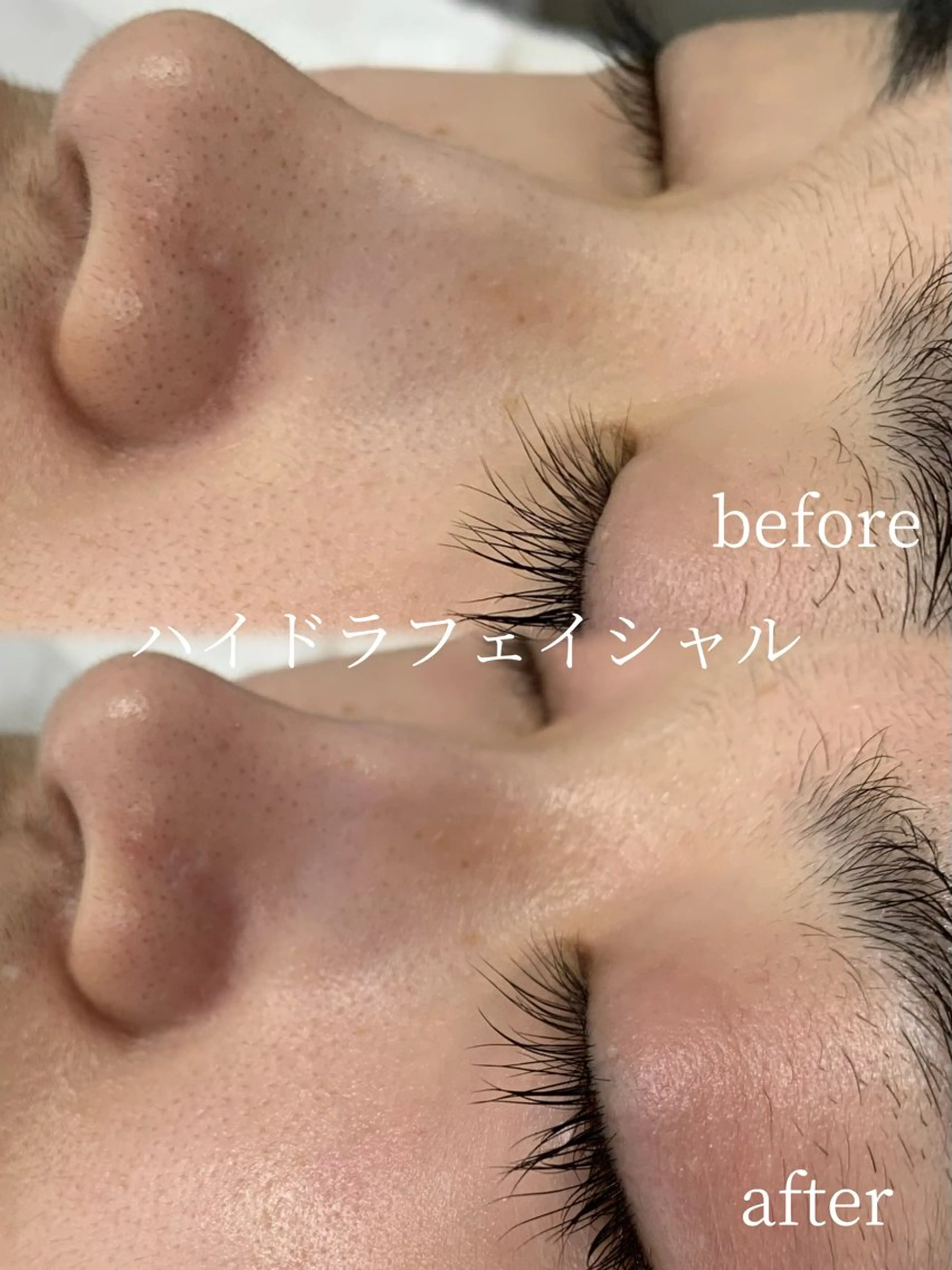 エステ リラク lifra CHISAのマツエク・マツパデザイン