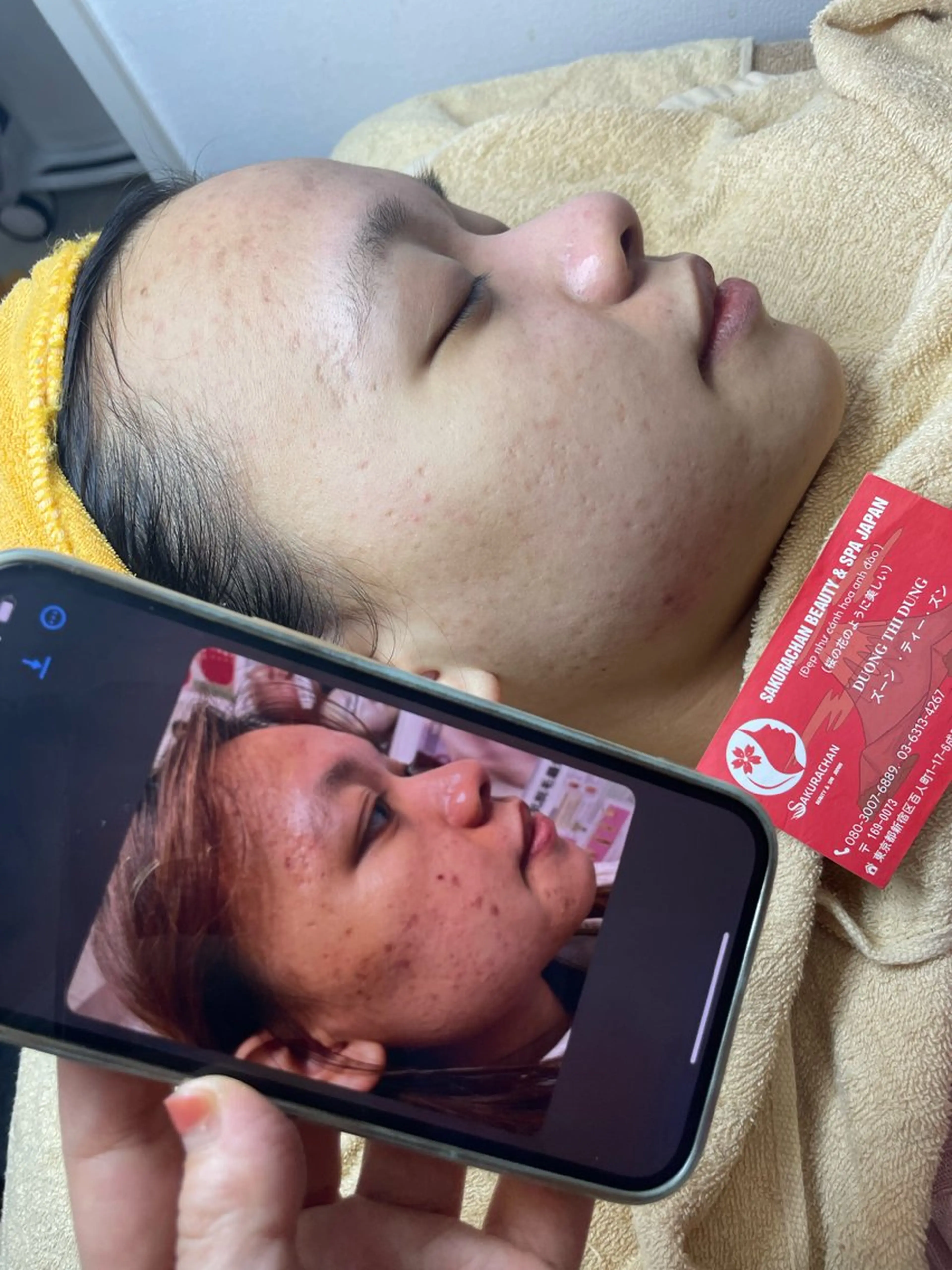 エステ ニキビ、痩身、脱毛、 サクラチャンスパのエステ・リラクイメージ