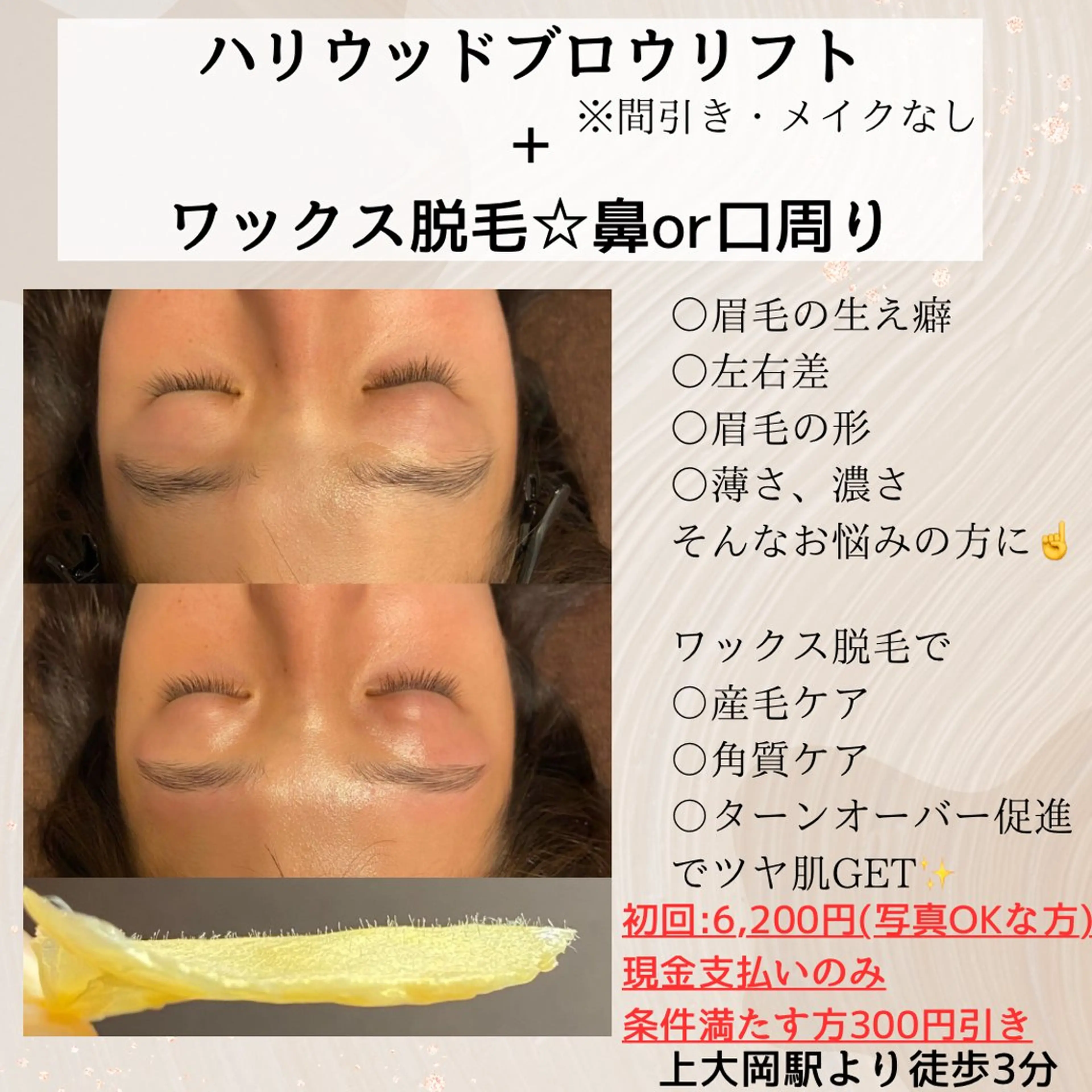 HBL眉癖改善施術+フェイシャルワックス脱毛(鼻or口周り)カウンセリング→眉癖改善→ワックス脱毛→毛抜きの写真