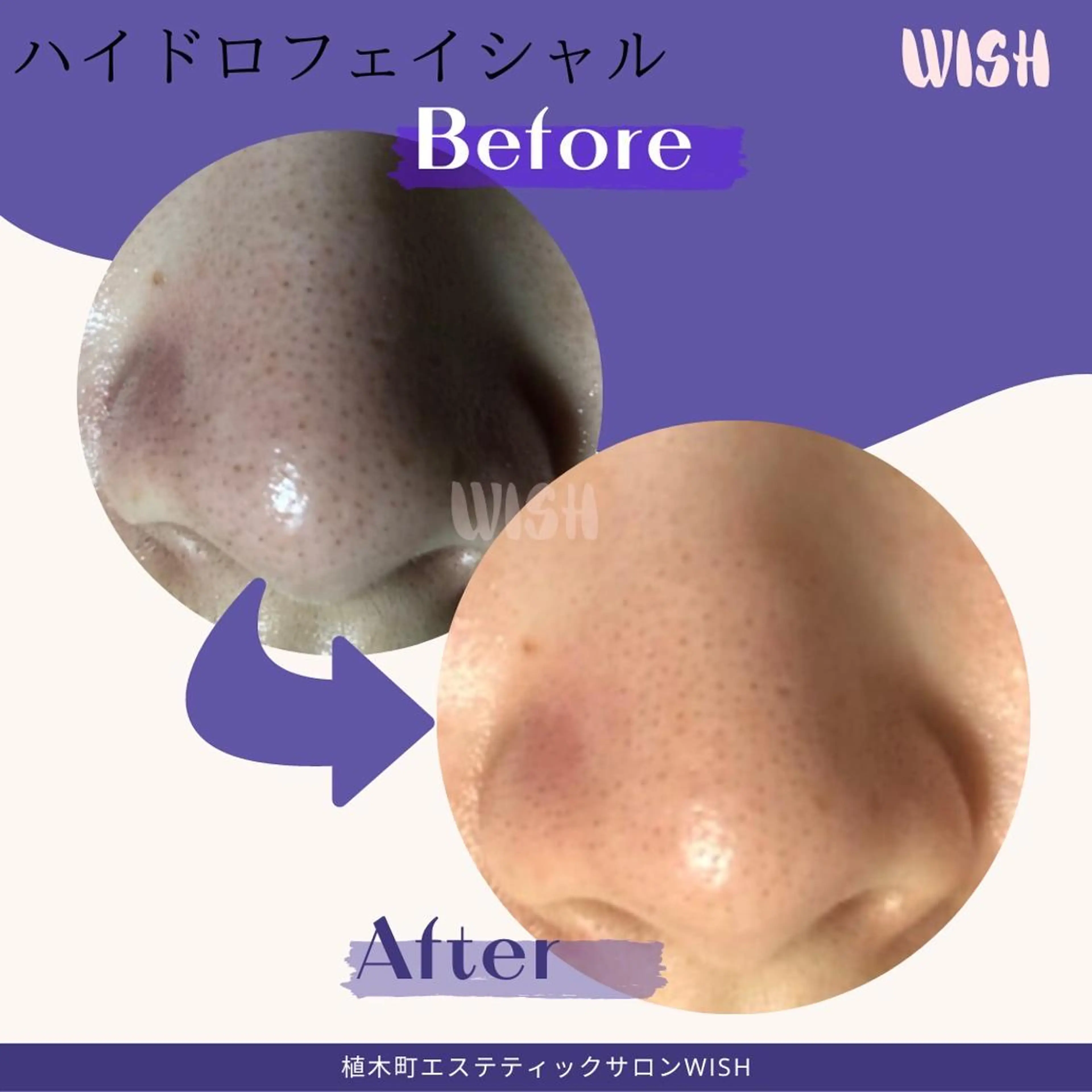 WISH 美肌脱毛のプロ！須藤のエステ・リラクイメージ