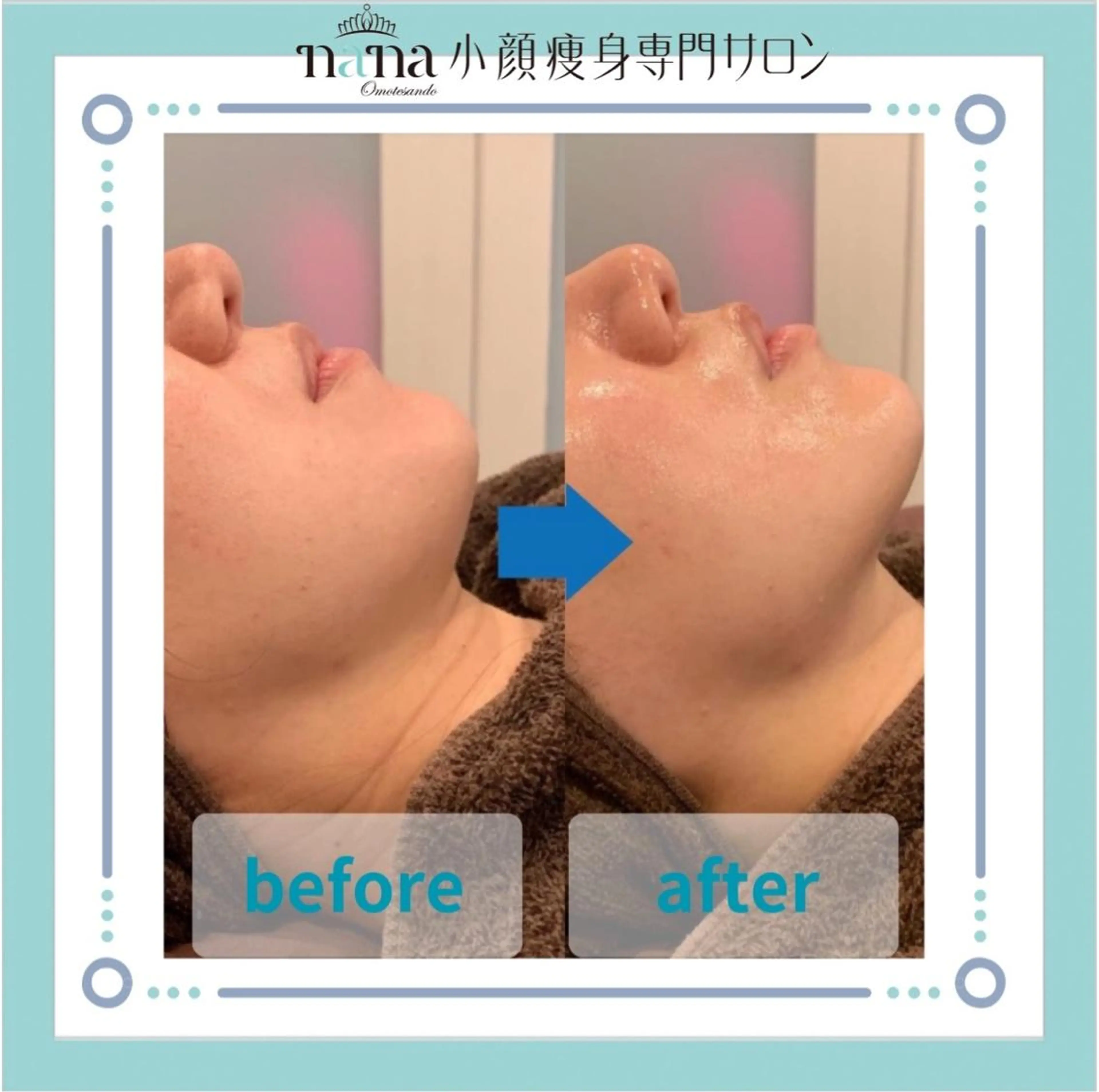 小顔痩身インディバ Nana表参道のエステ・リラクイメージ