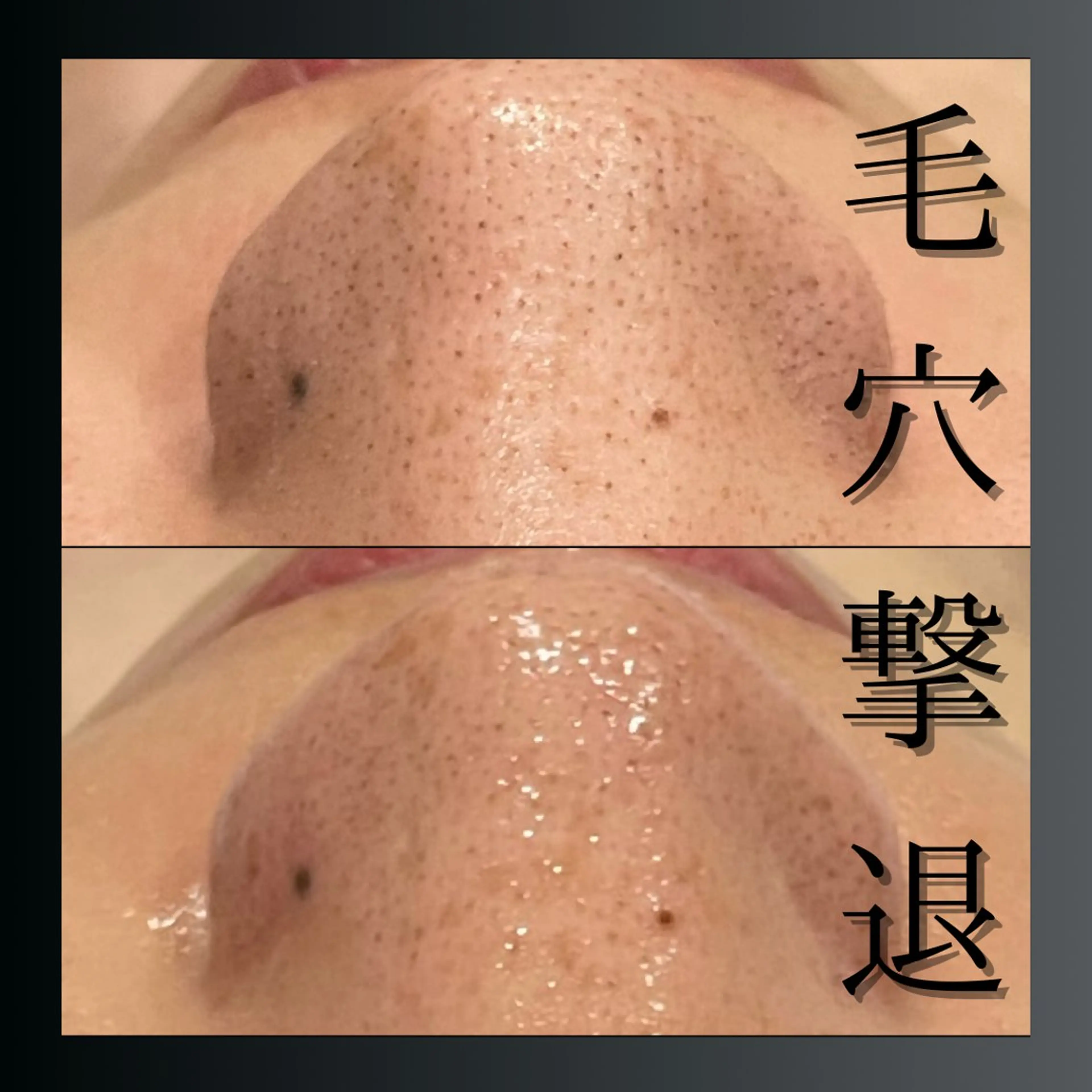 LiZA エステティックサロンのエステ・リラクイメージ