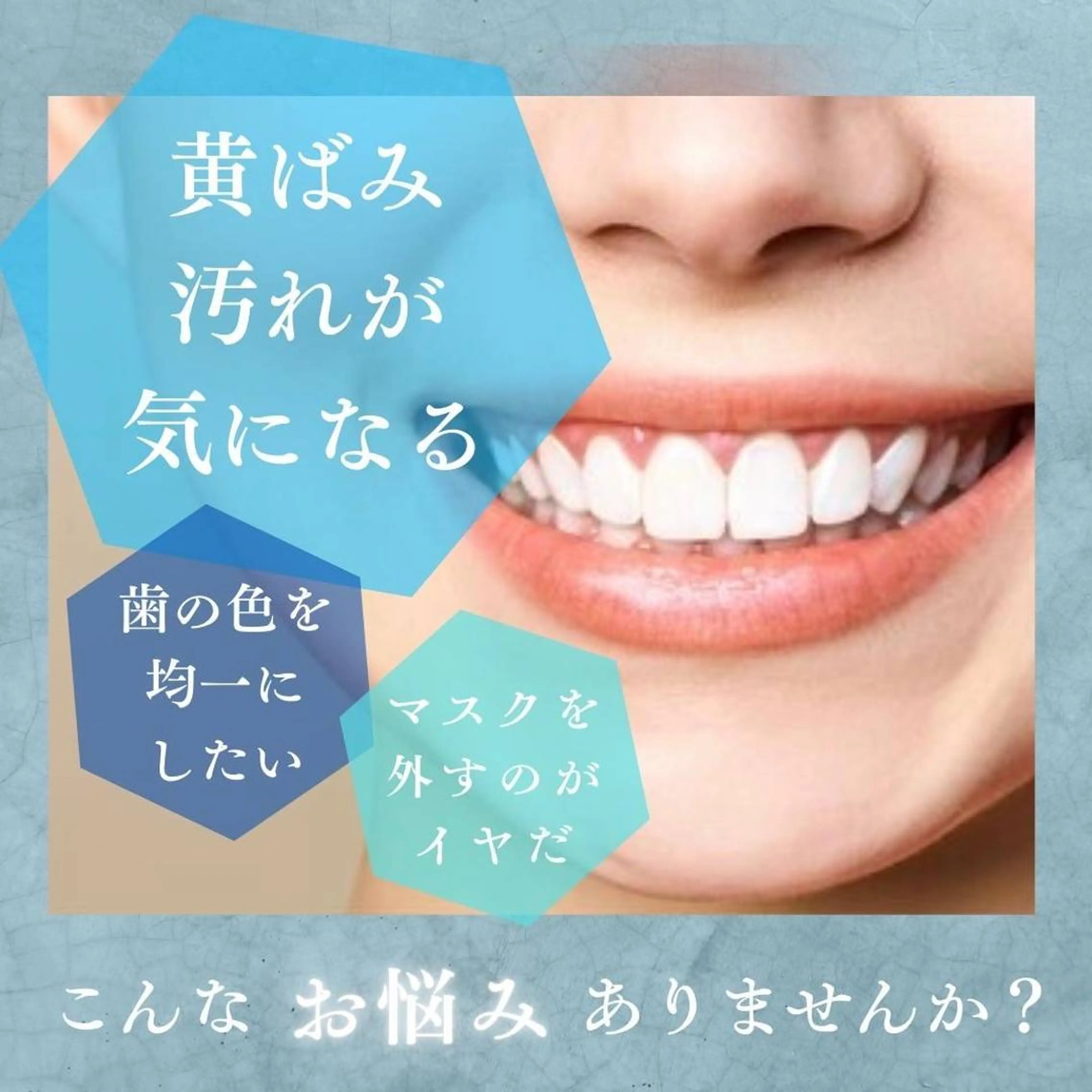 パーマ セミロング その他 ホワイトニングサロン nico西葛西店のその他イメージ