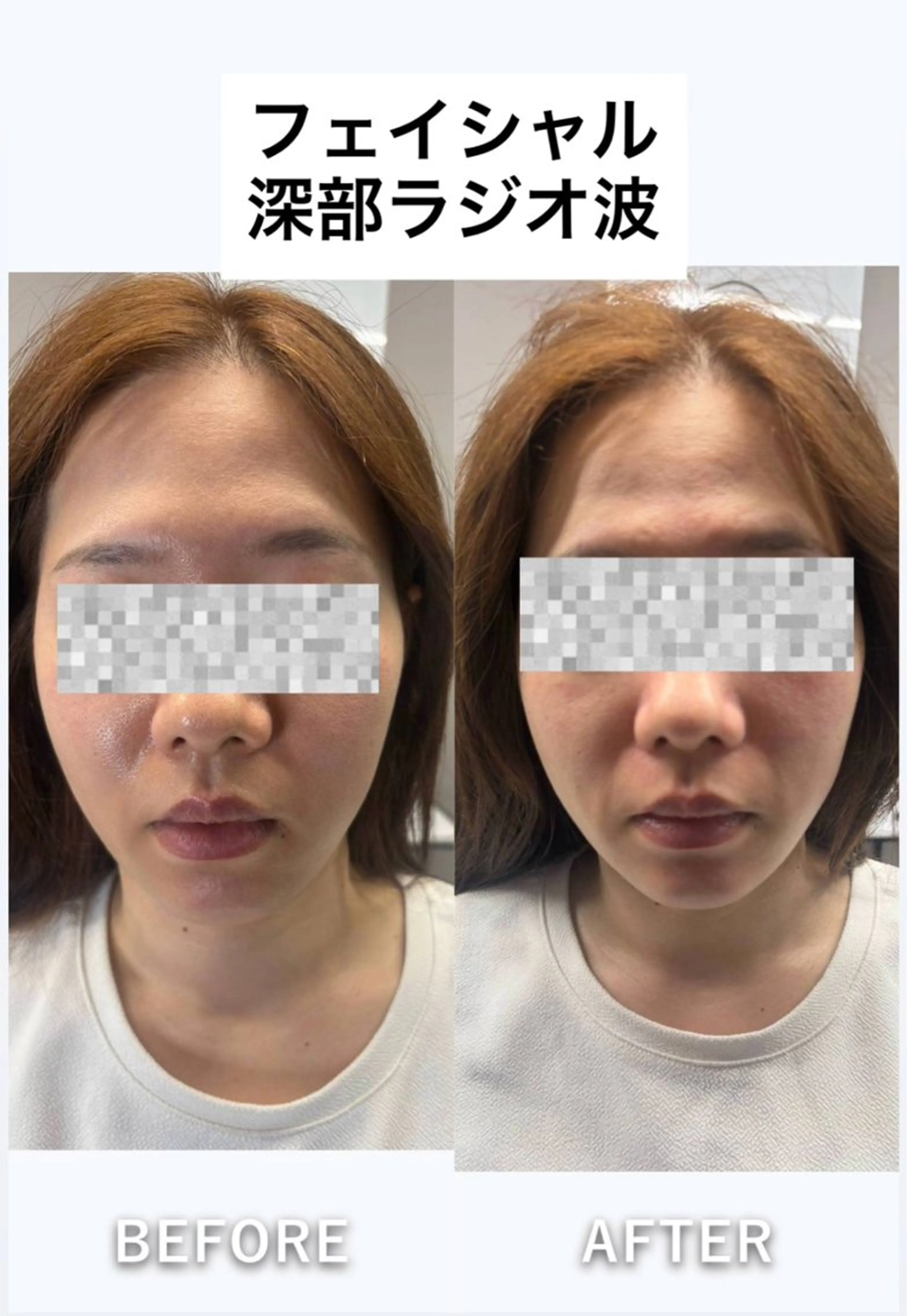 エステ 美容整体・塗る漢方・フェイシャルRechica所属・心斎橋痩身 美肌整体サロン💓のエステ・リラクイメージ