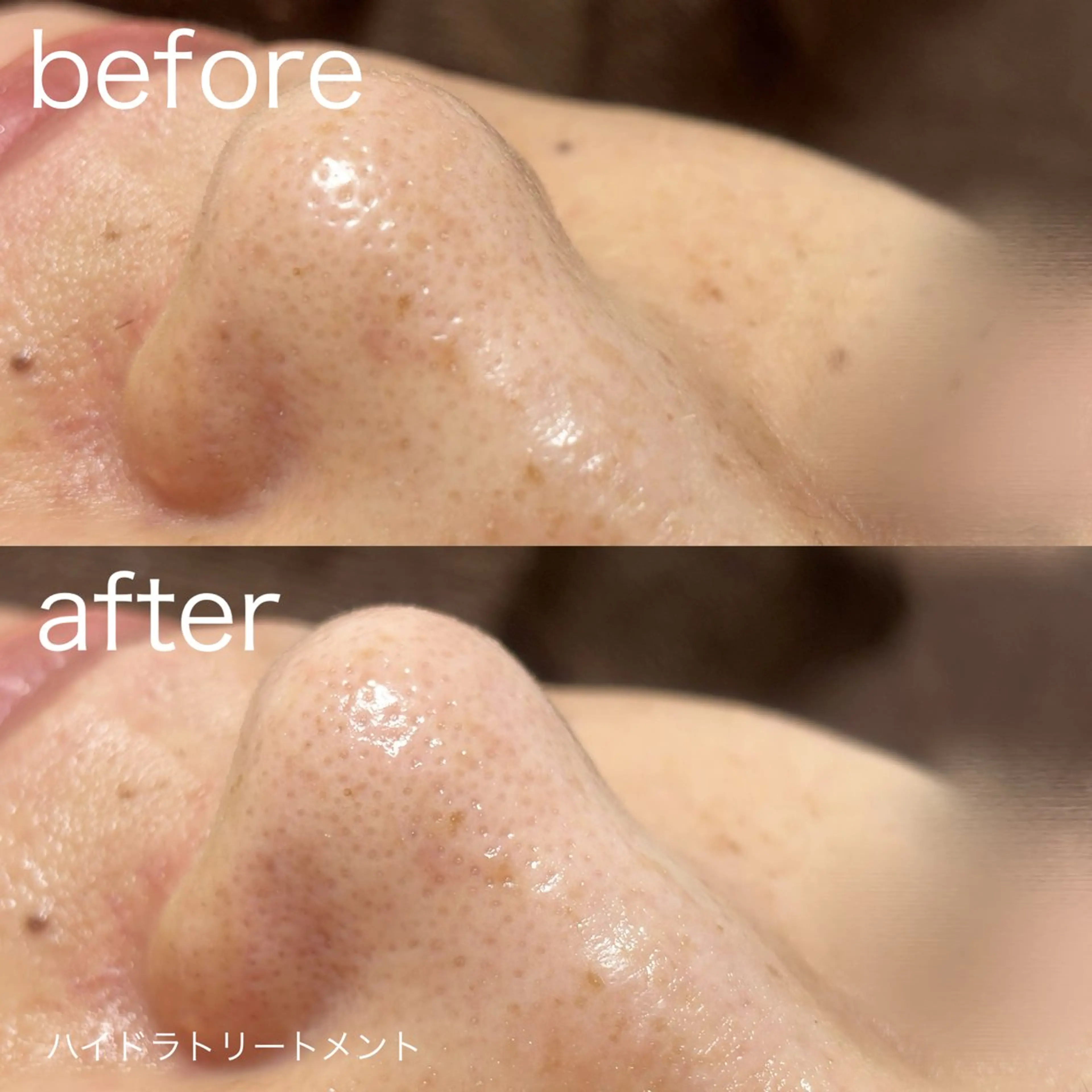 その他 lulularico Yuのエステ・リラクイメージ