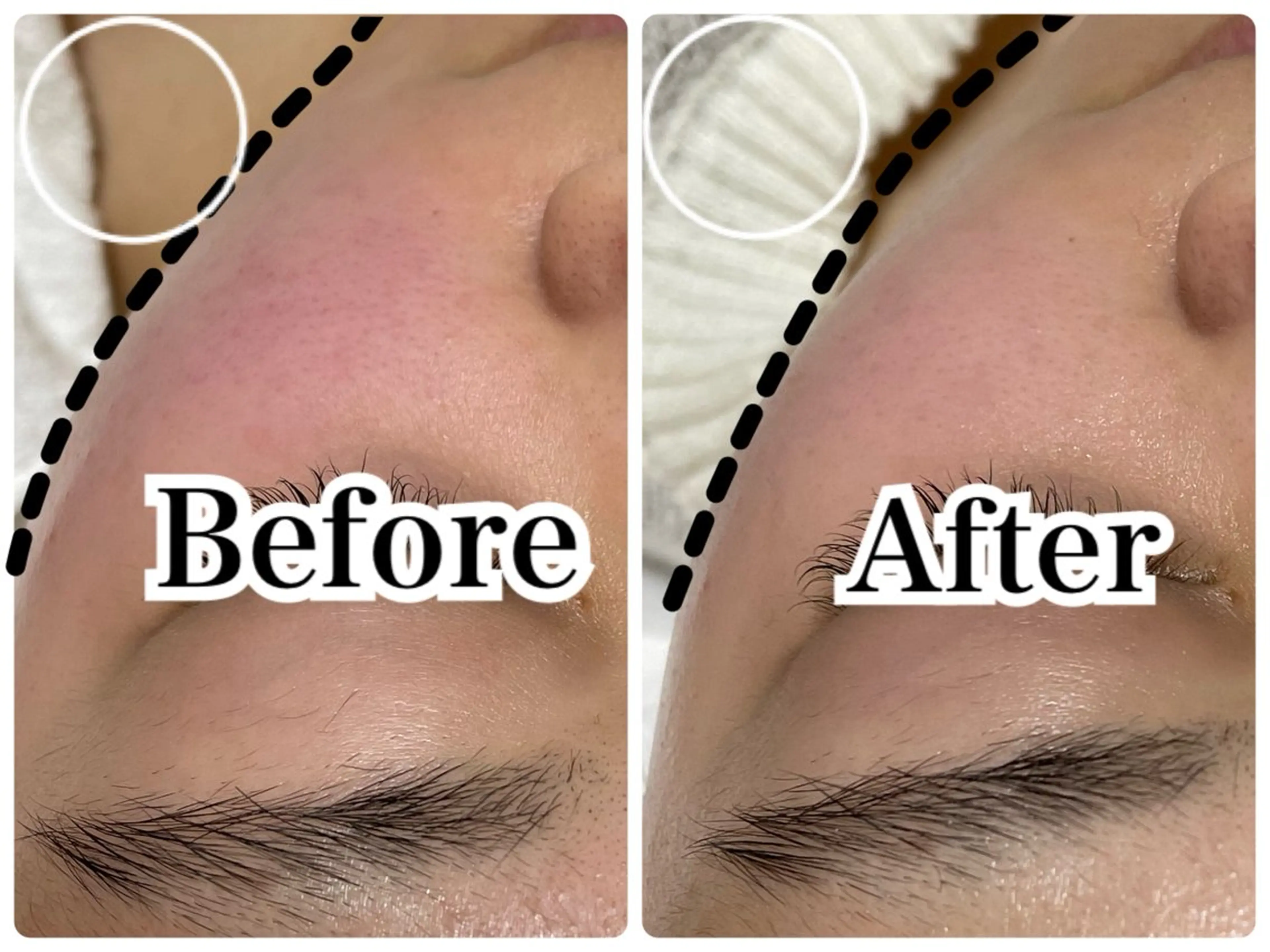 エステ デ・アイム豊中所属・朝山 紗世子のエステ・リラクイメージ