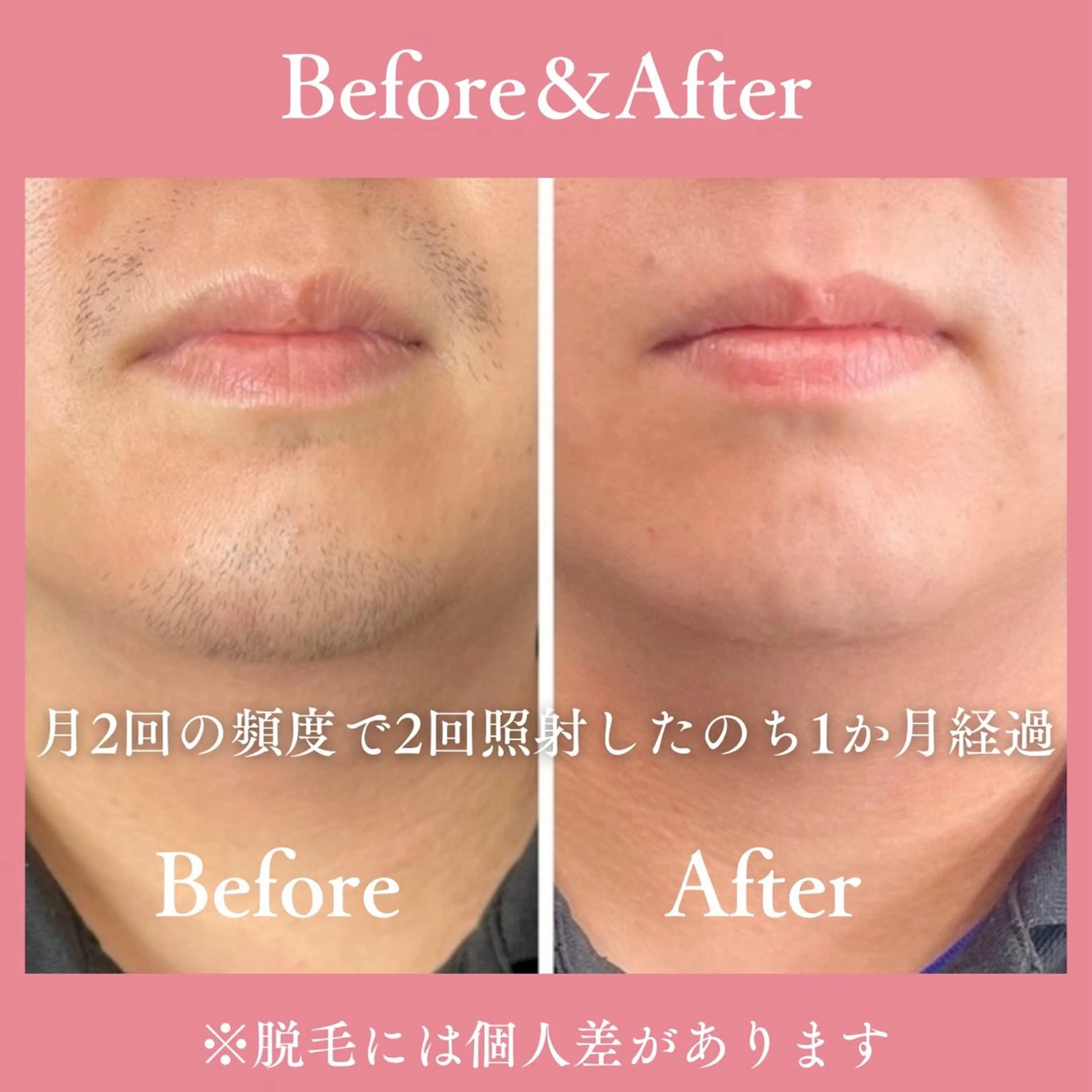 メンズ 有人型セルフサロン 脱毛/痩身/美顔のその他イメージ