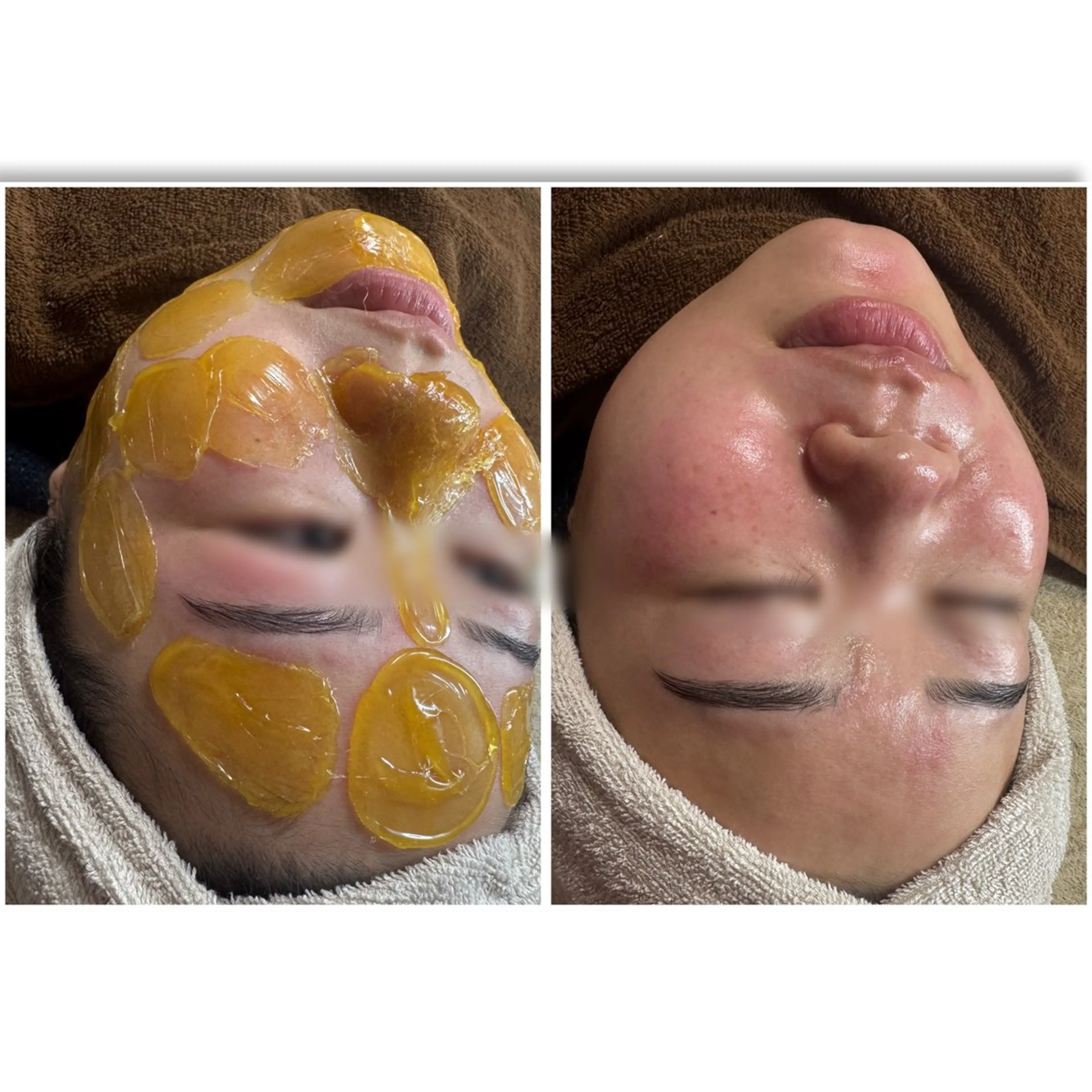 エステ yuuri. Sの眉毛・アイブロウイメージ