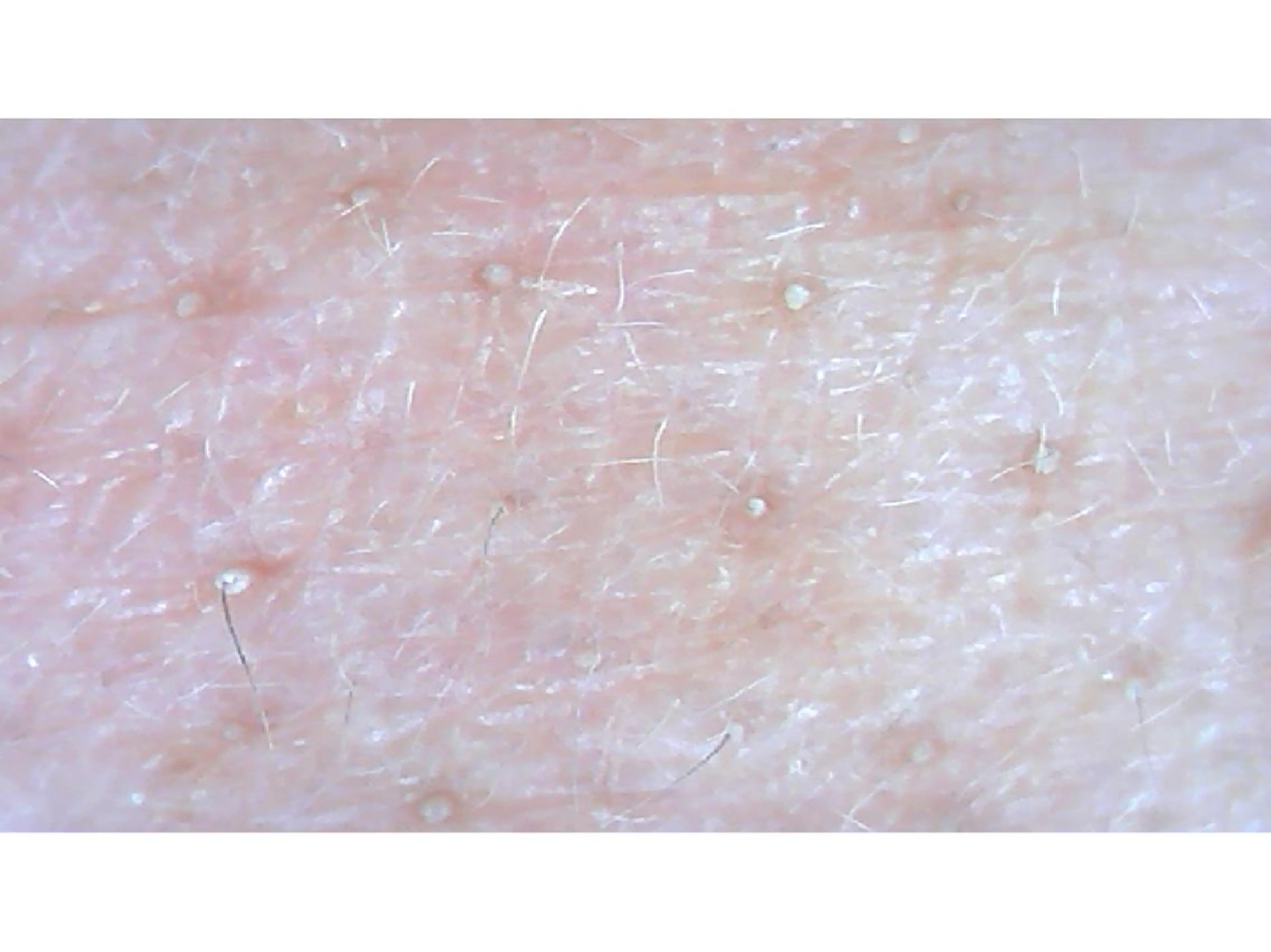 エステ リラク 宮野 麻綺のエステ・リラクイメージ