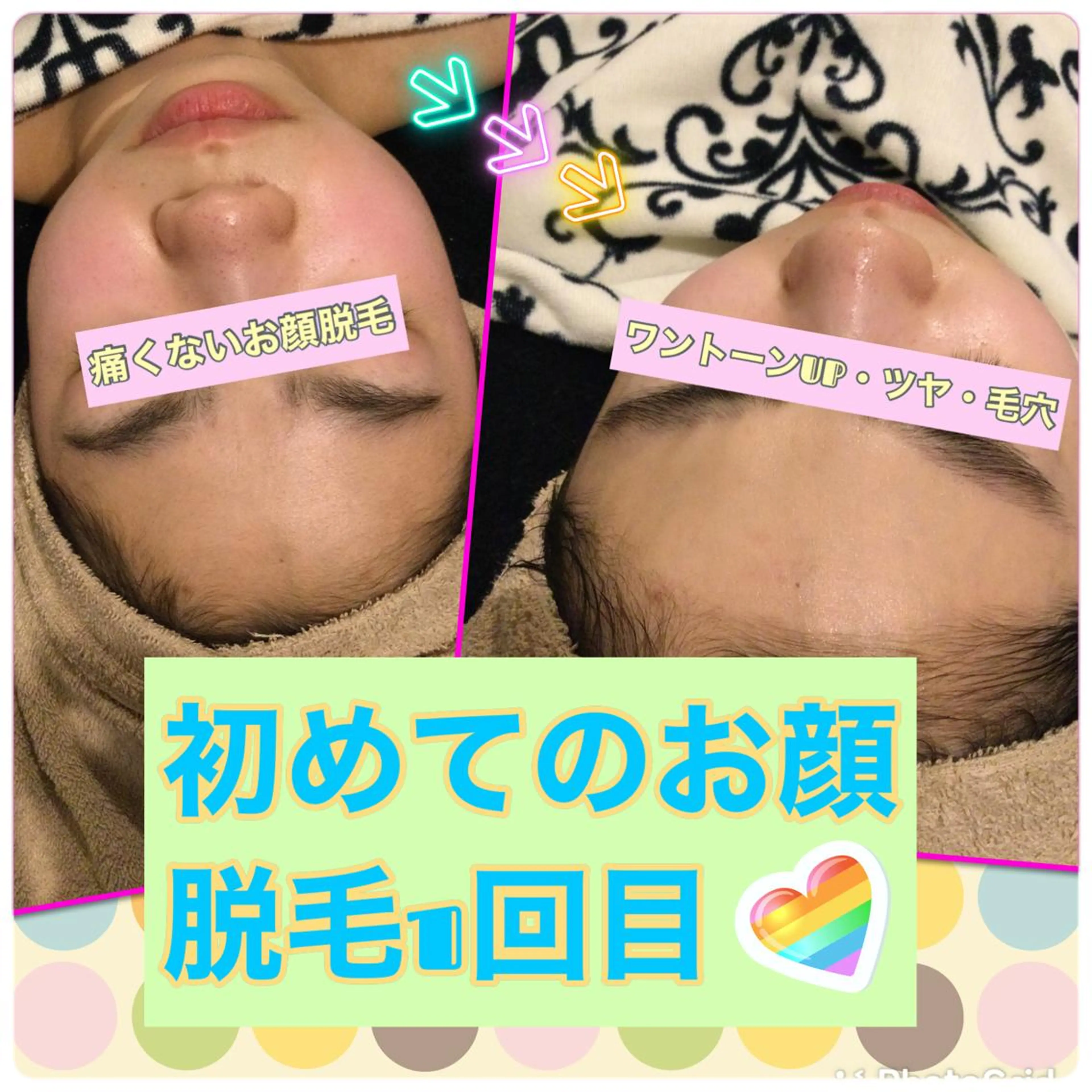 【リベルハーブピーリング認定店】敏感肌・美白脱毛専門店Dione立川店所属・Dione 立川店のエステ・リラクイメージ