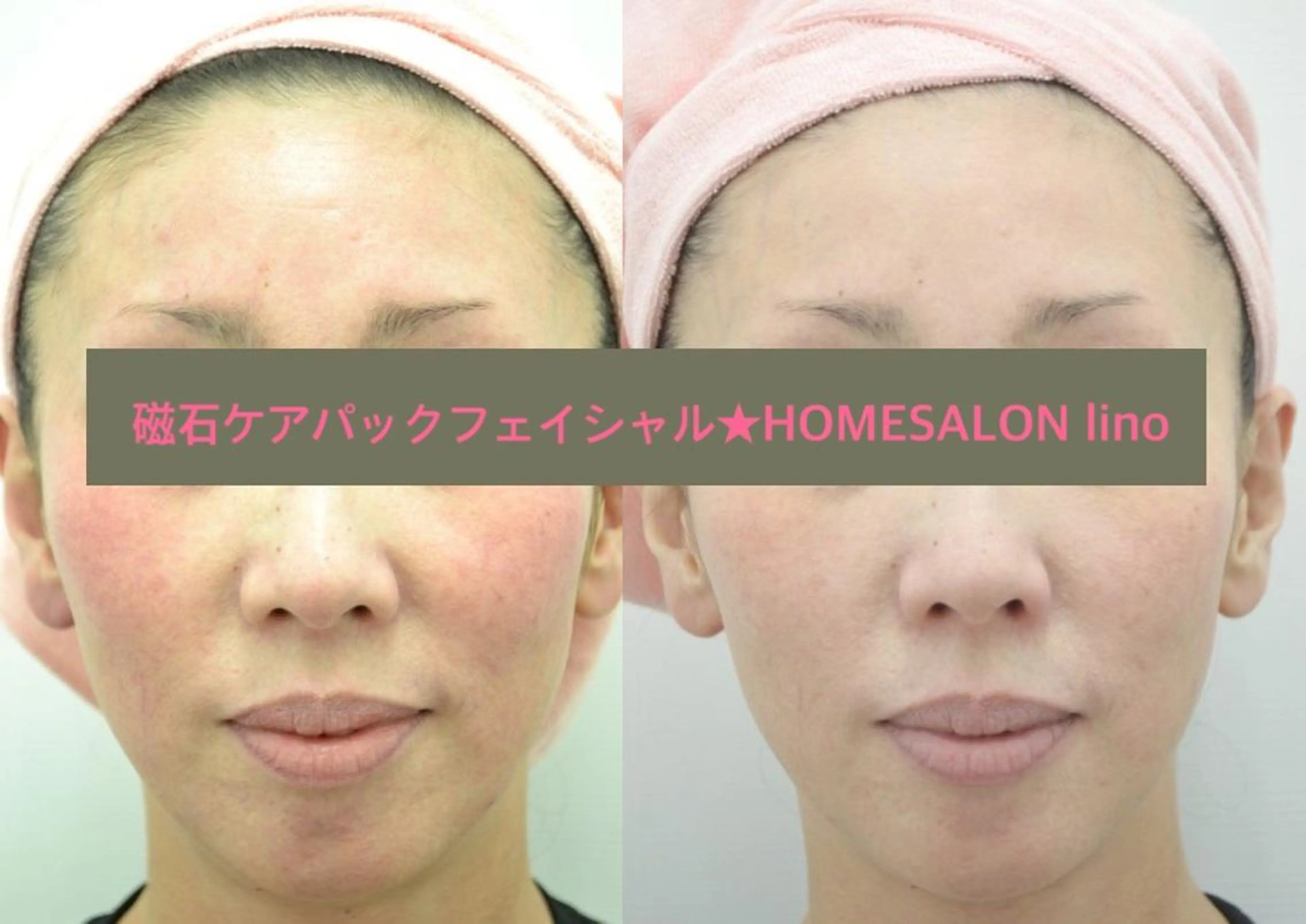エステ HOME SALON linoのエステ・リラクイメージ