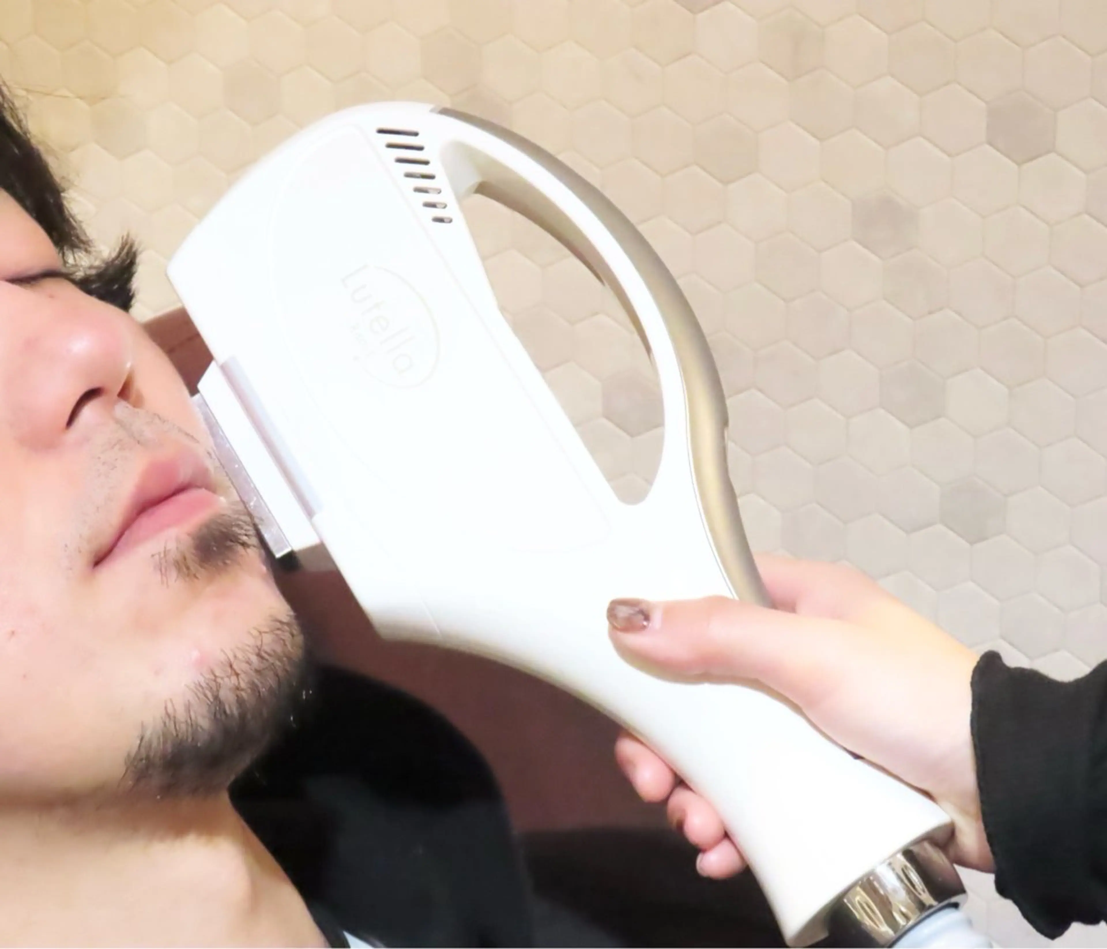 ひげ脱毛の写真