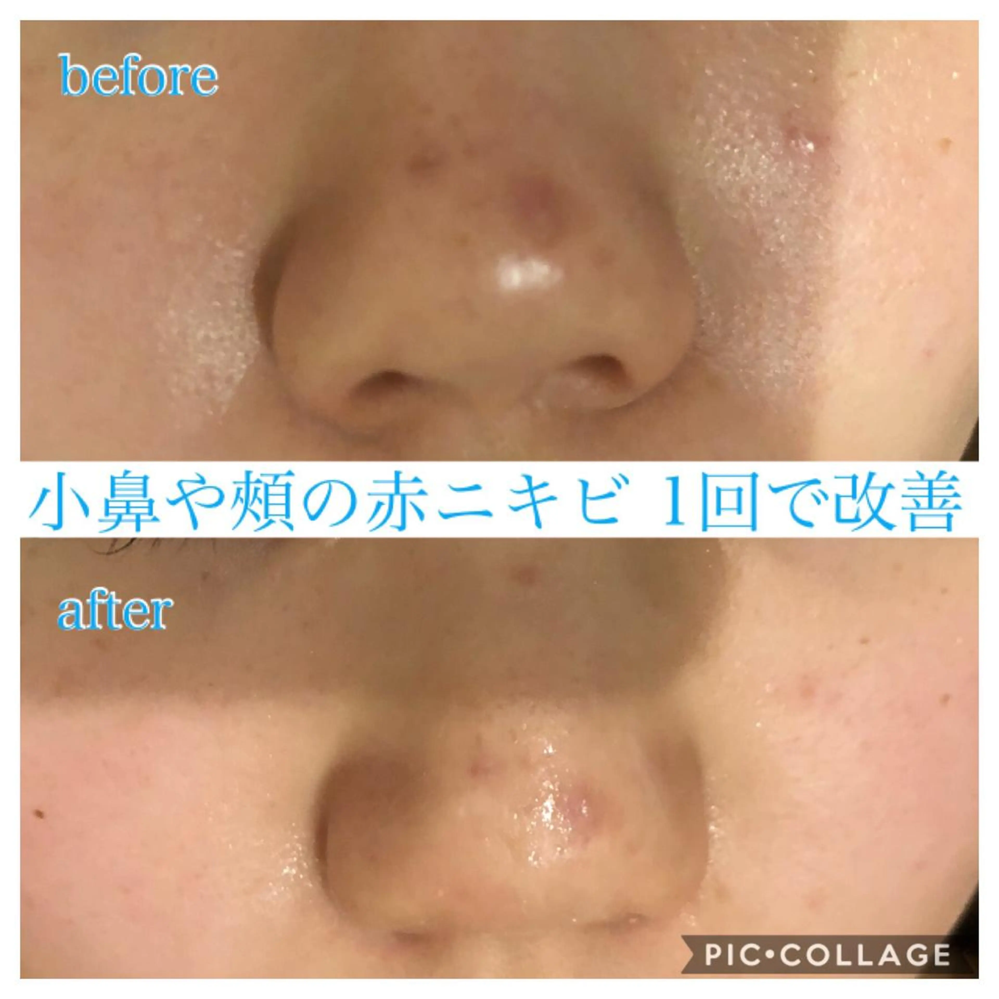 ロング カラー パーマ ヘアアレンジ キッズ ネイル マツエク・マツパ エステ リラク Ensor Clair所属・EnsorClair 代表 野口真央のエステ・リラクイメージ