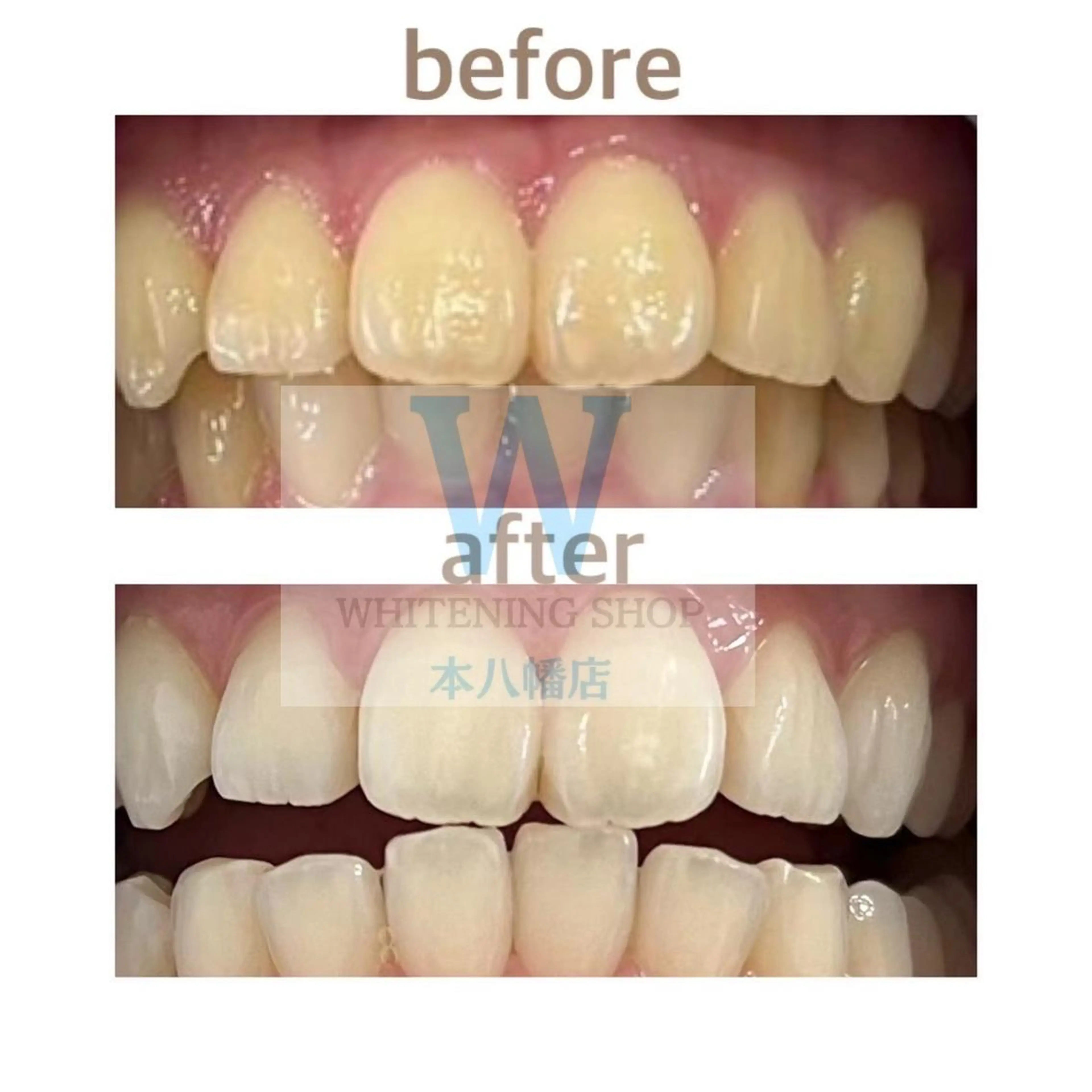 エステ リラク ホワイトニング ショップ本八幡店のエステ・リラクイメージ