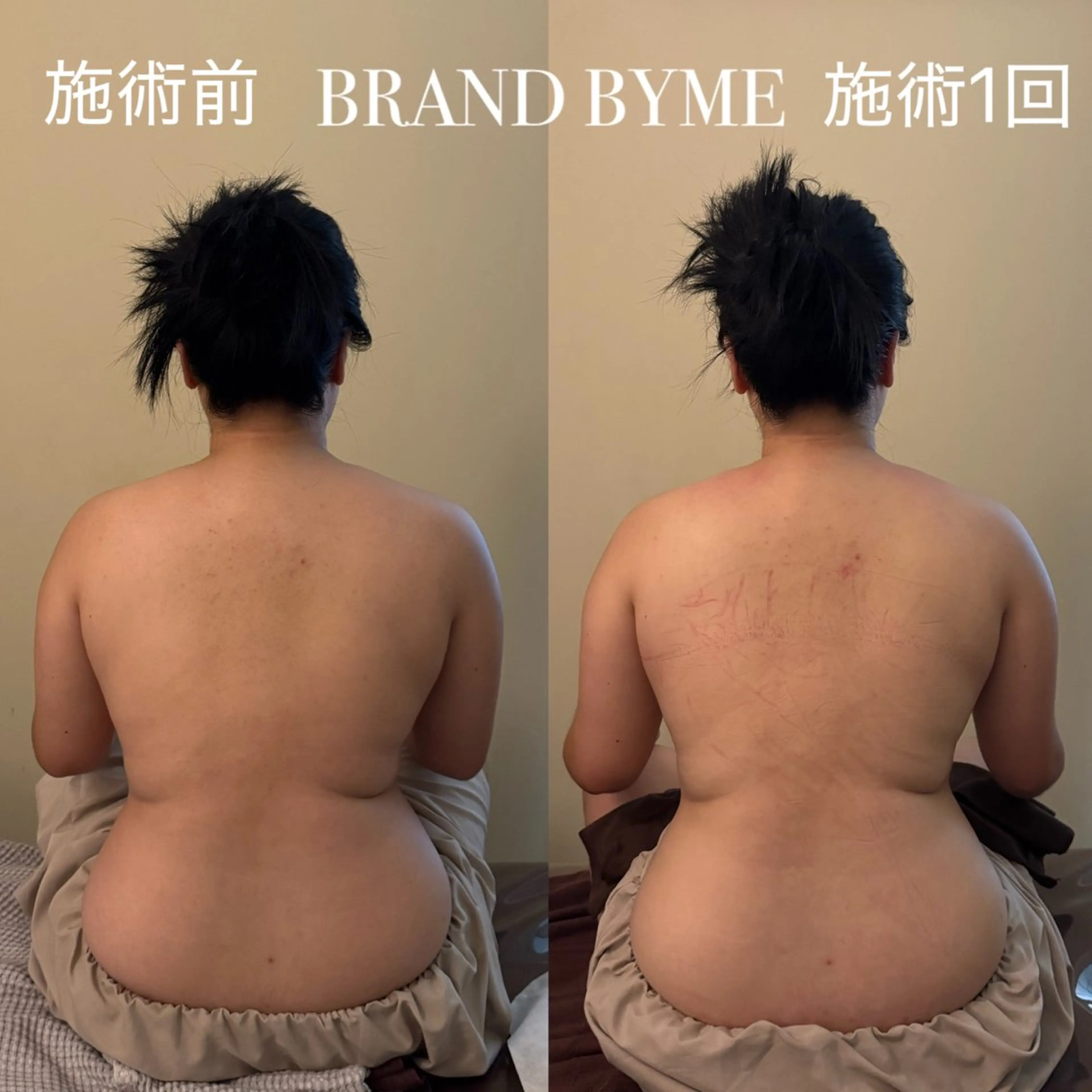 Brand byme 上野店のエステ・リラクイメージ