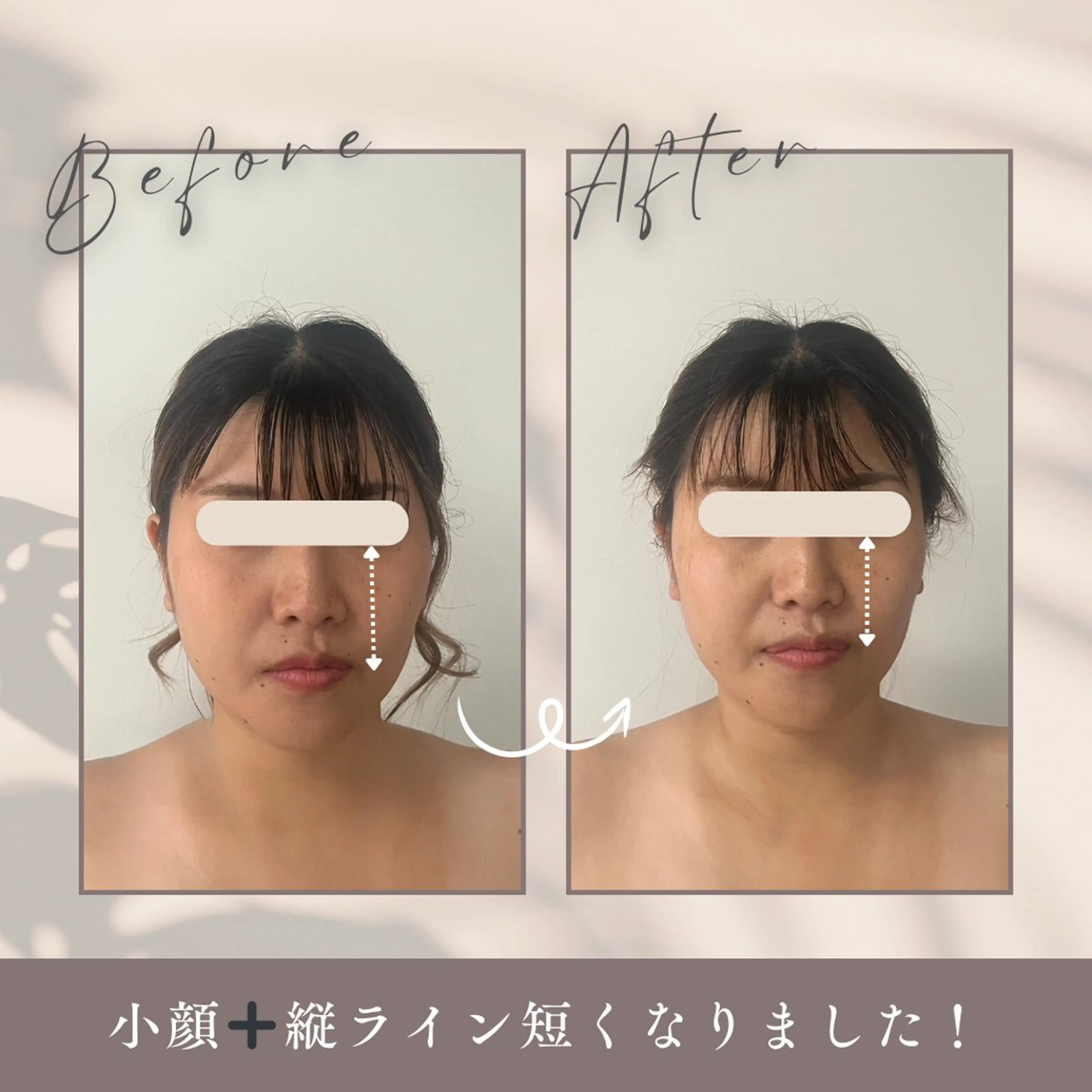 【単品メニュー】面長調整の写真