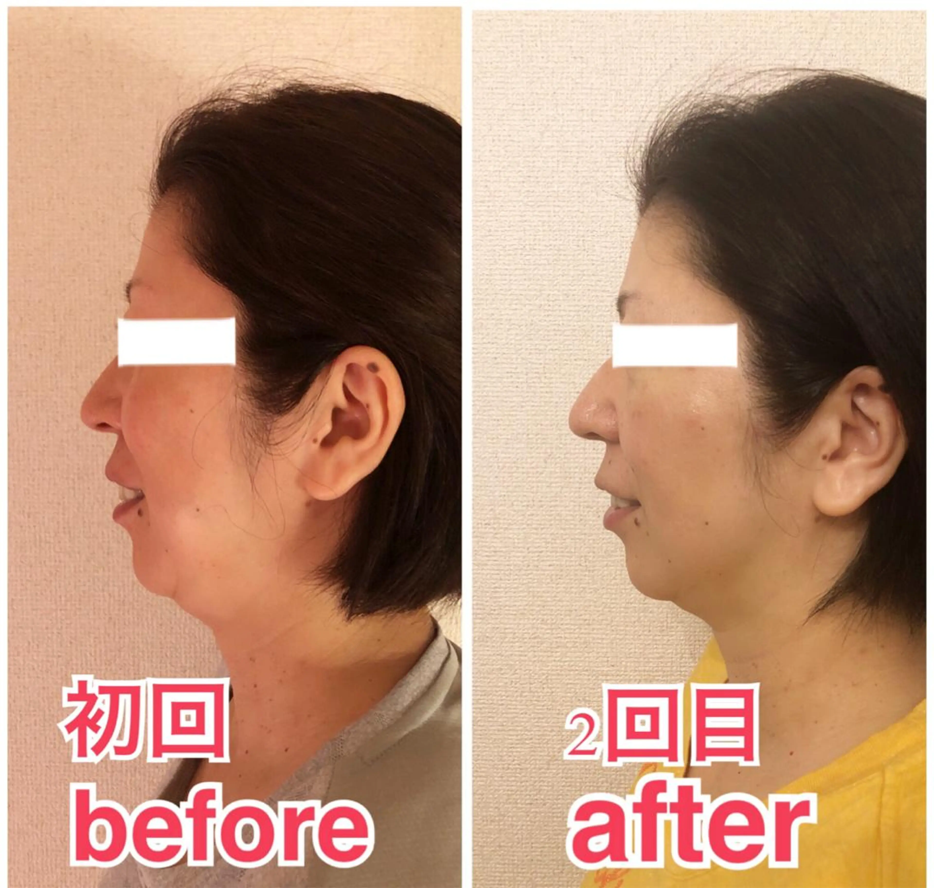 エステ リラク 小顔矯正専門サロンジュマリ所属・町田 淳子のエステ・リラクイメージ