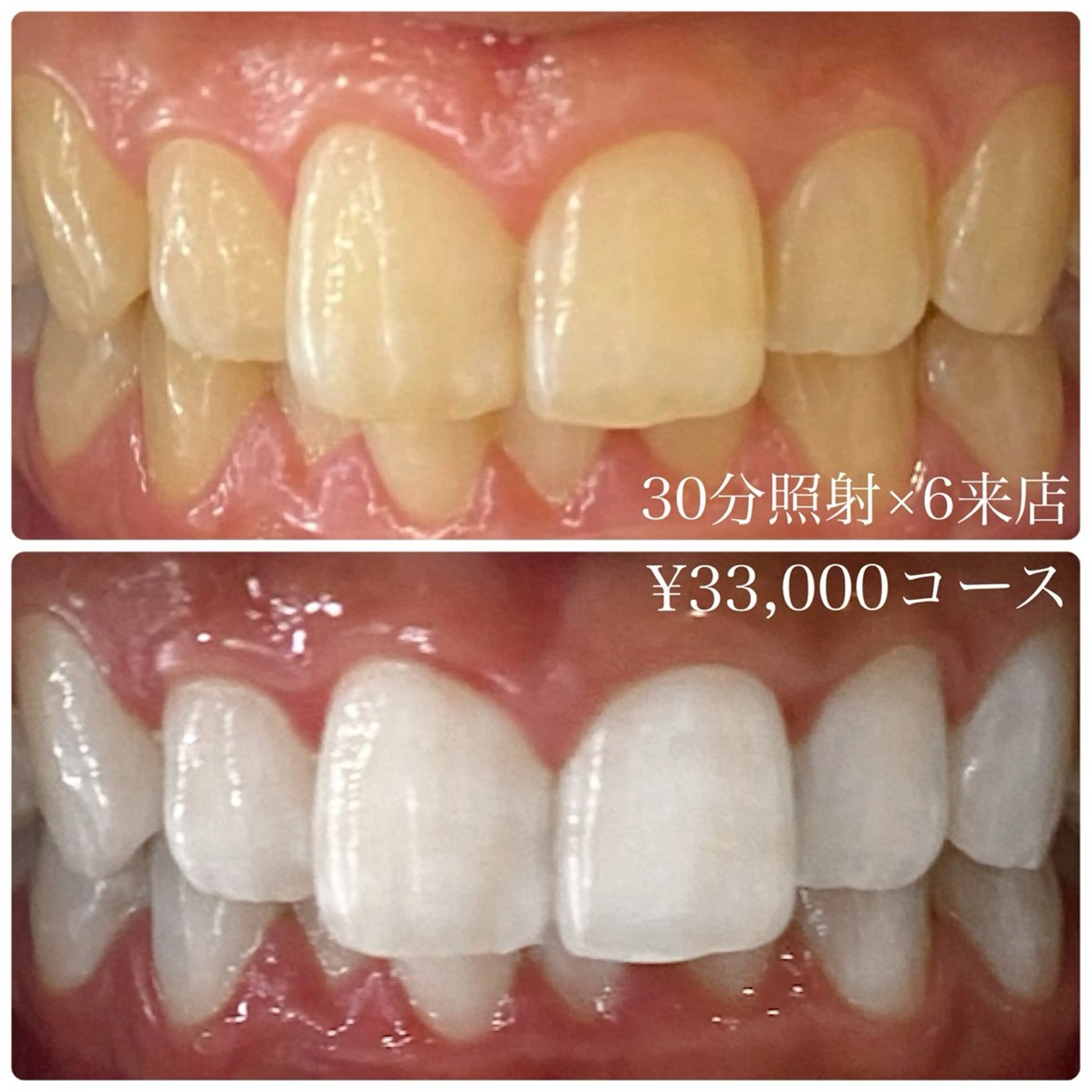 PLATINUM Beauty 横浜店所属・ホワイトニングルーム 横浜店のその他イメージ