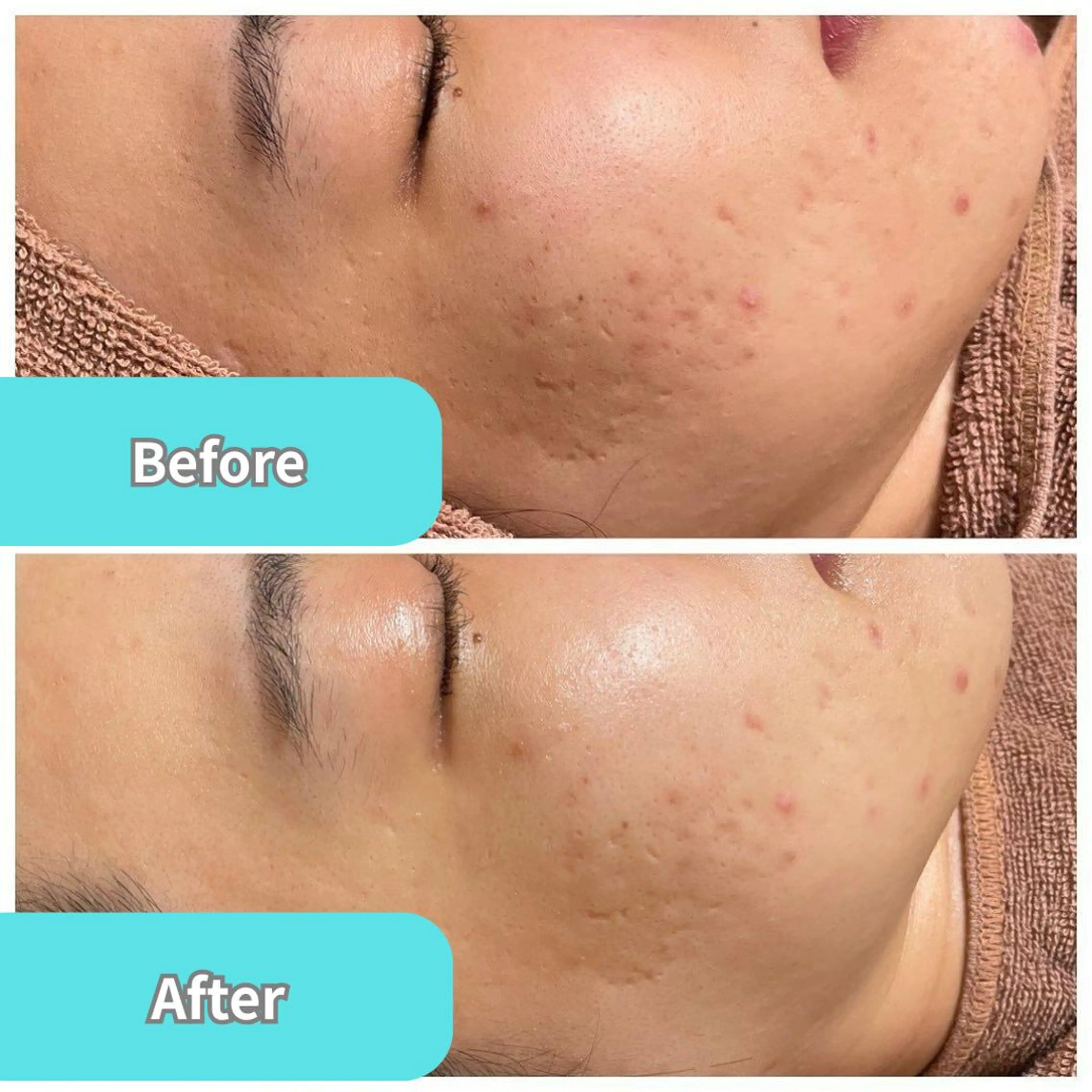 脱毛TWINKLE Shimadaのエステ・リラクイメージ