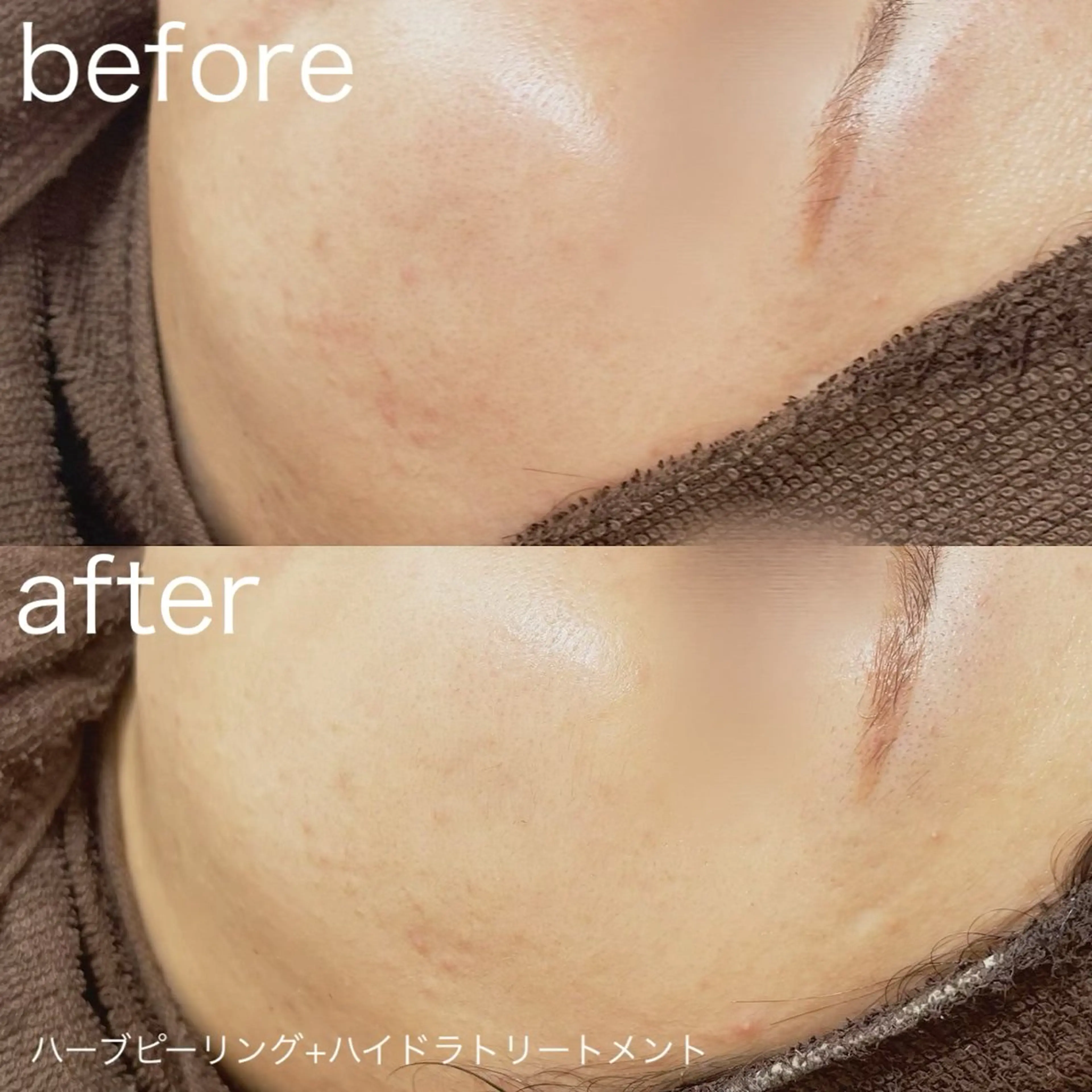 その他 lulularico Yu🫧のエステ・リラクイメージ