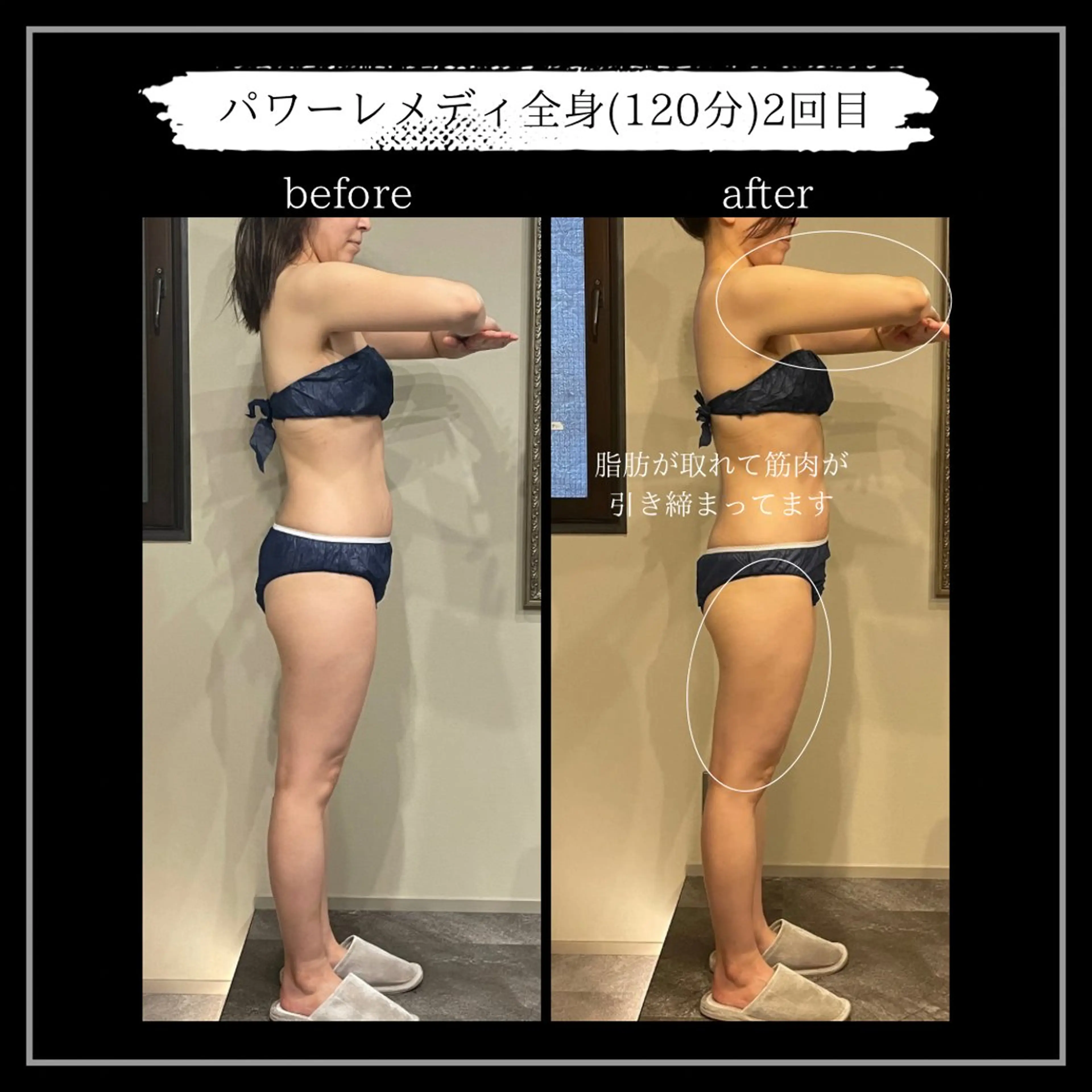 オフ:オン所属・オフ:オン 全身筋膜マッサージのエステ・リラクイメージ