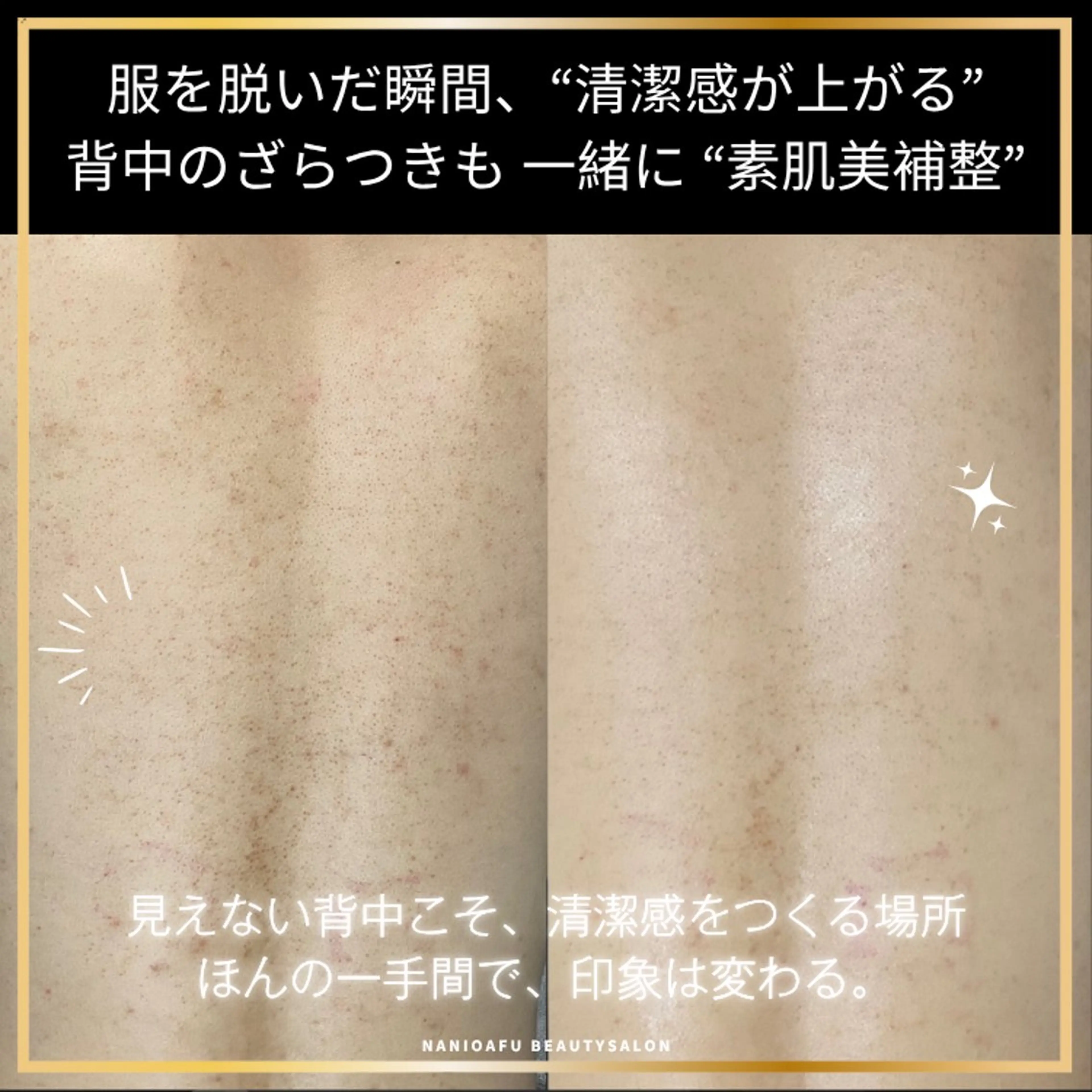 エステ リラク NANI OAFU所属・NANIOAFU [なんば店］のエステ・リラクイメージ