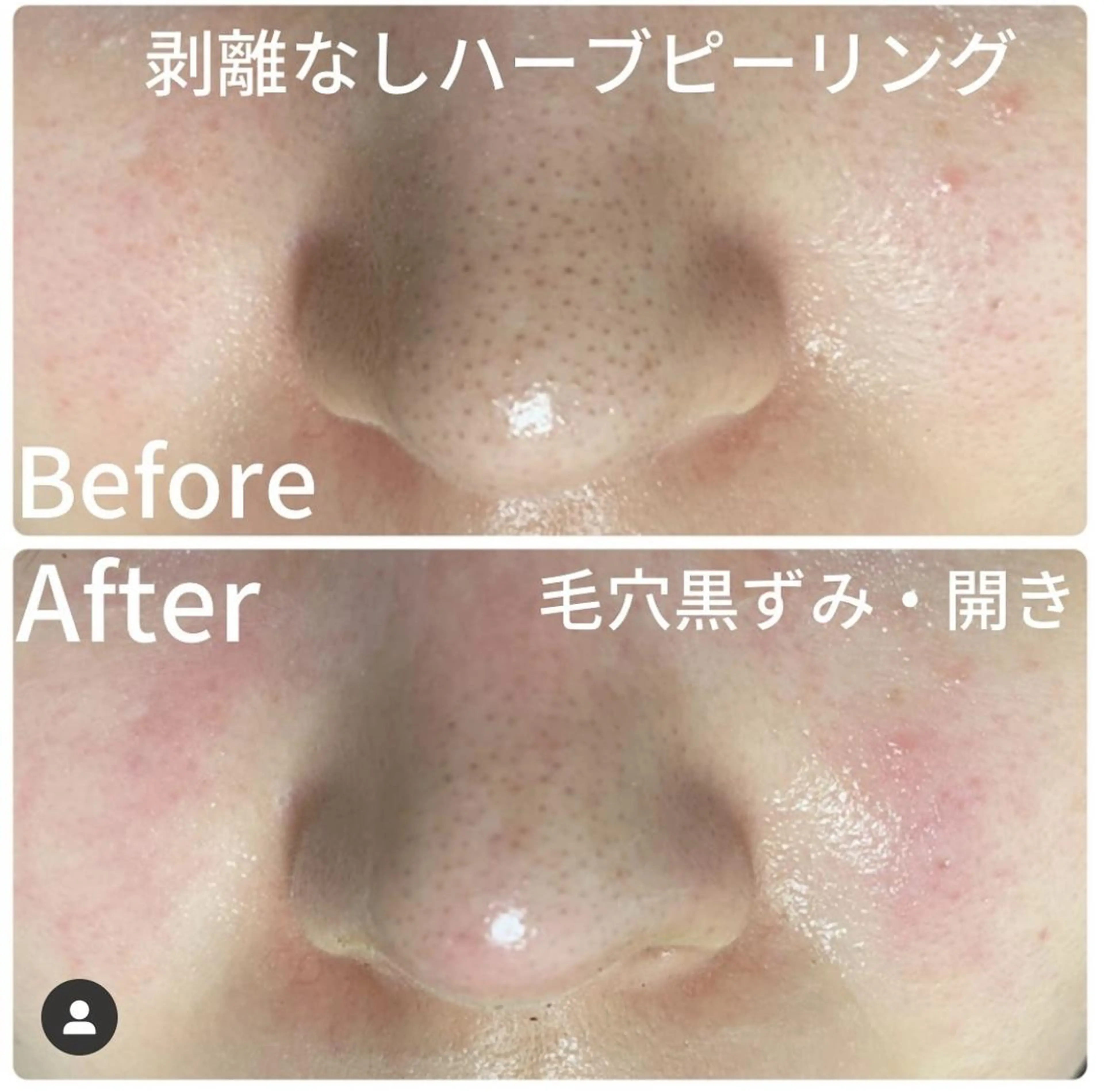 Einami 美肌痩身サロンのエステ・リラクイメージ