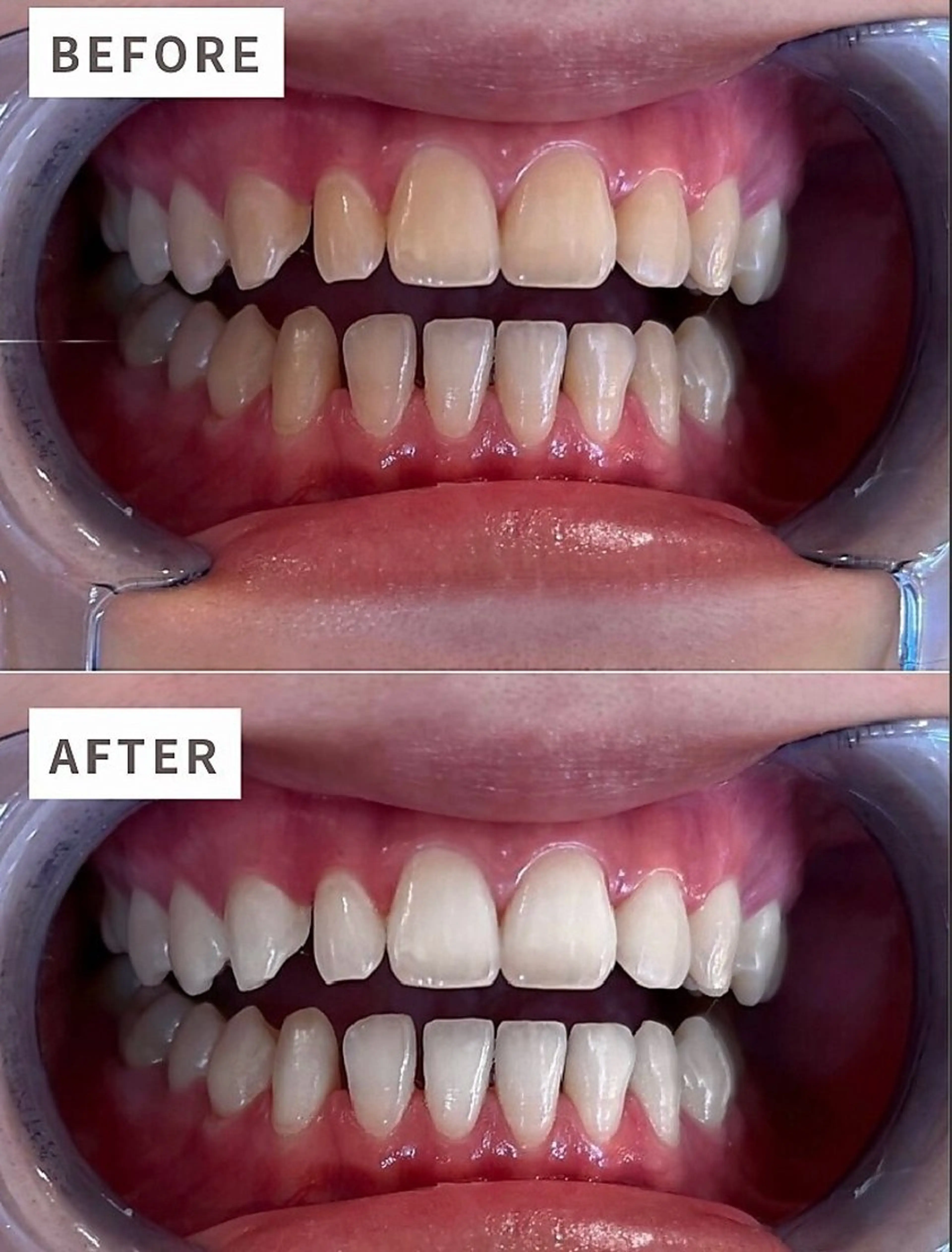 ecxia新宿西口店所属・セルフホワイトニング エクシア新宿西口店のその他イメージ