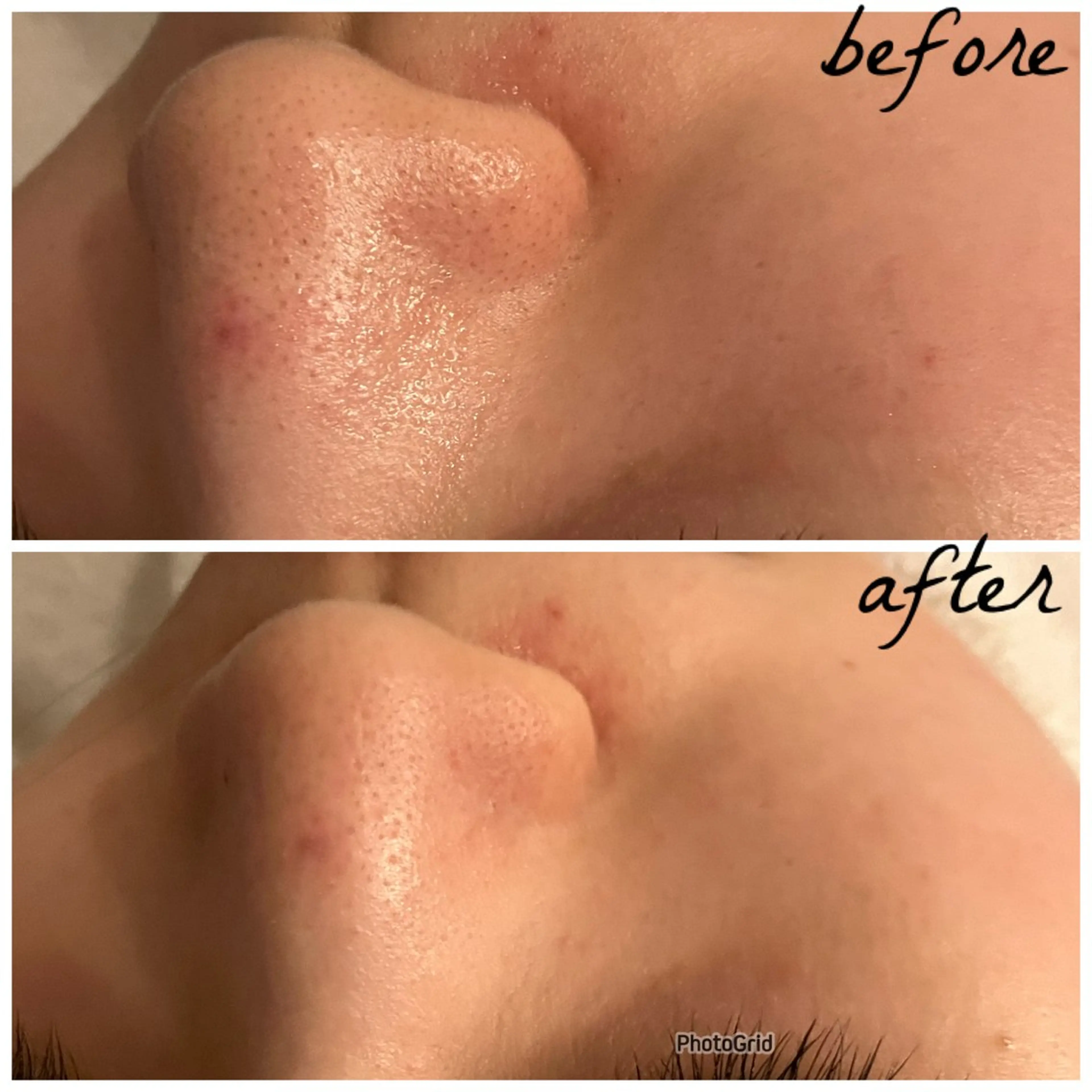 メンズ メナード岐阜茜部 杉浦のエステ・リラクイメージ