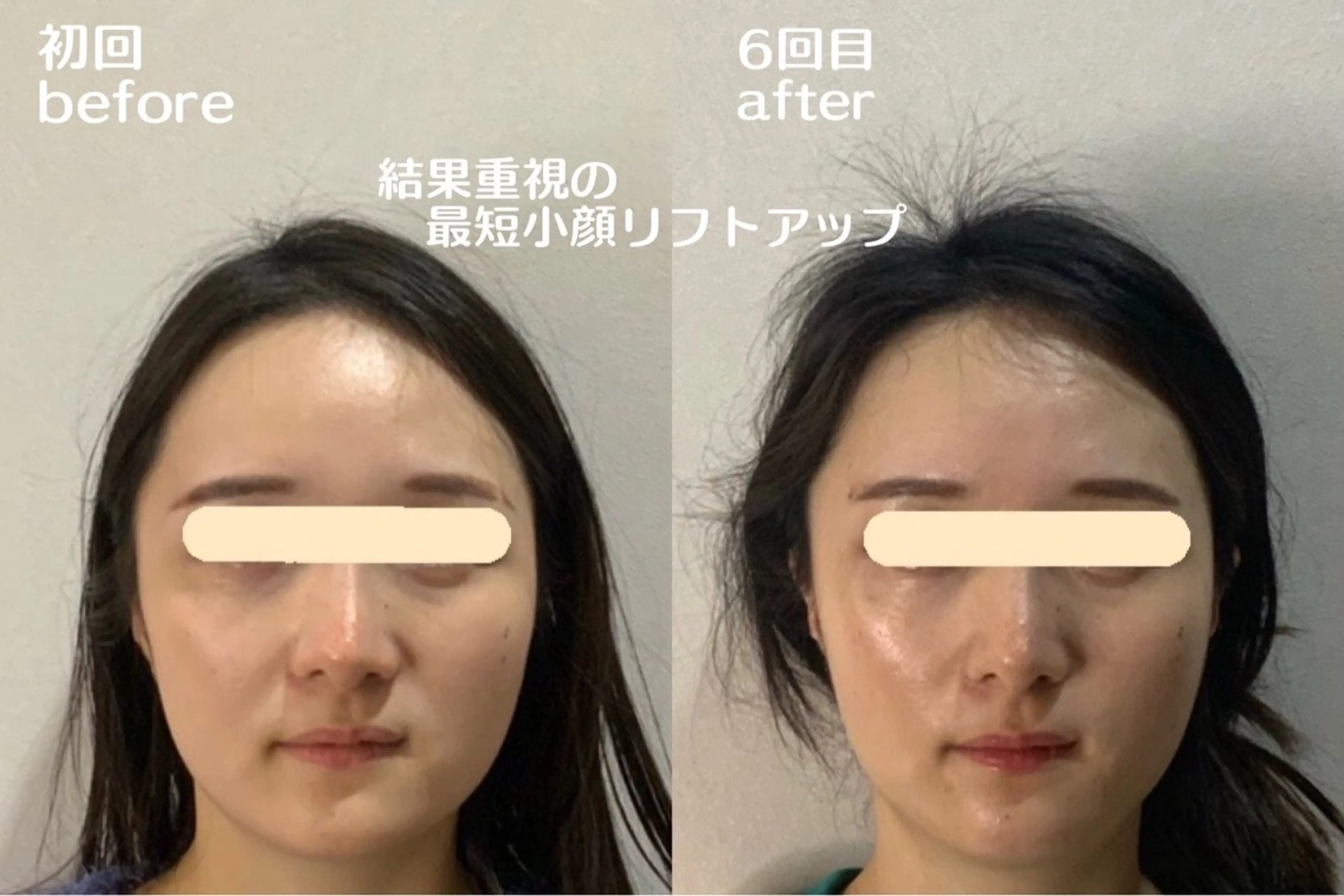 小顔・肌質改善 espoir 心斎橋のエステ・リラクイメージ