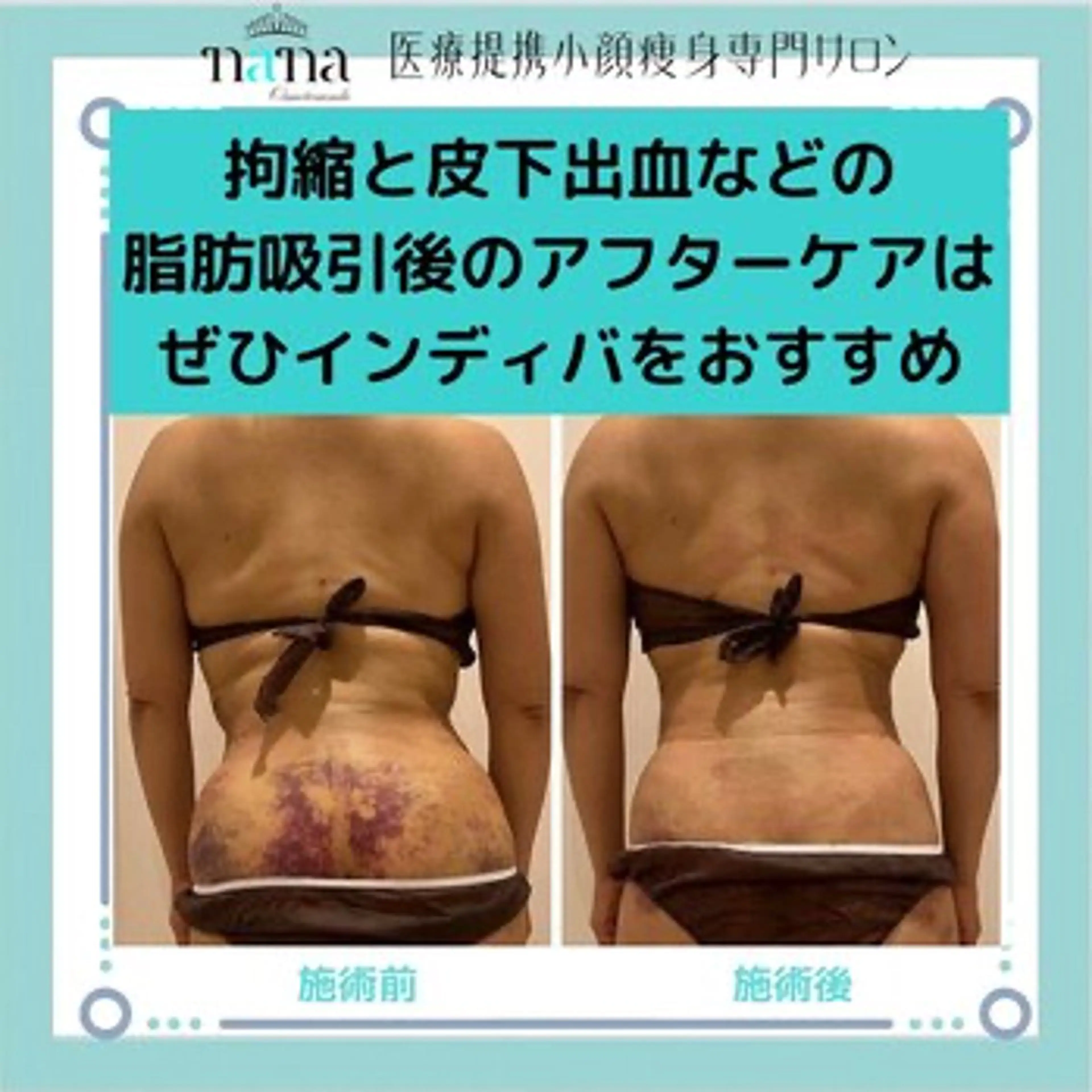 エステ リラク 小顔痩身インディバ Nana表参道のエステ・リラクイメージ