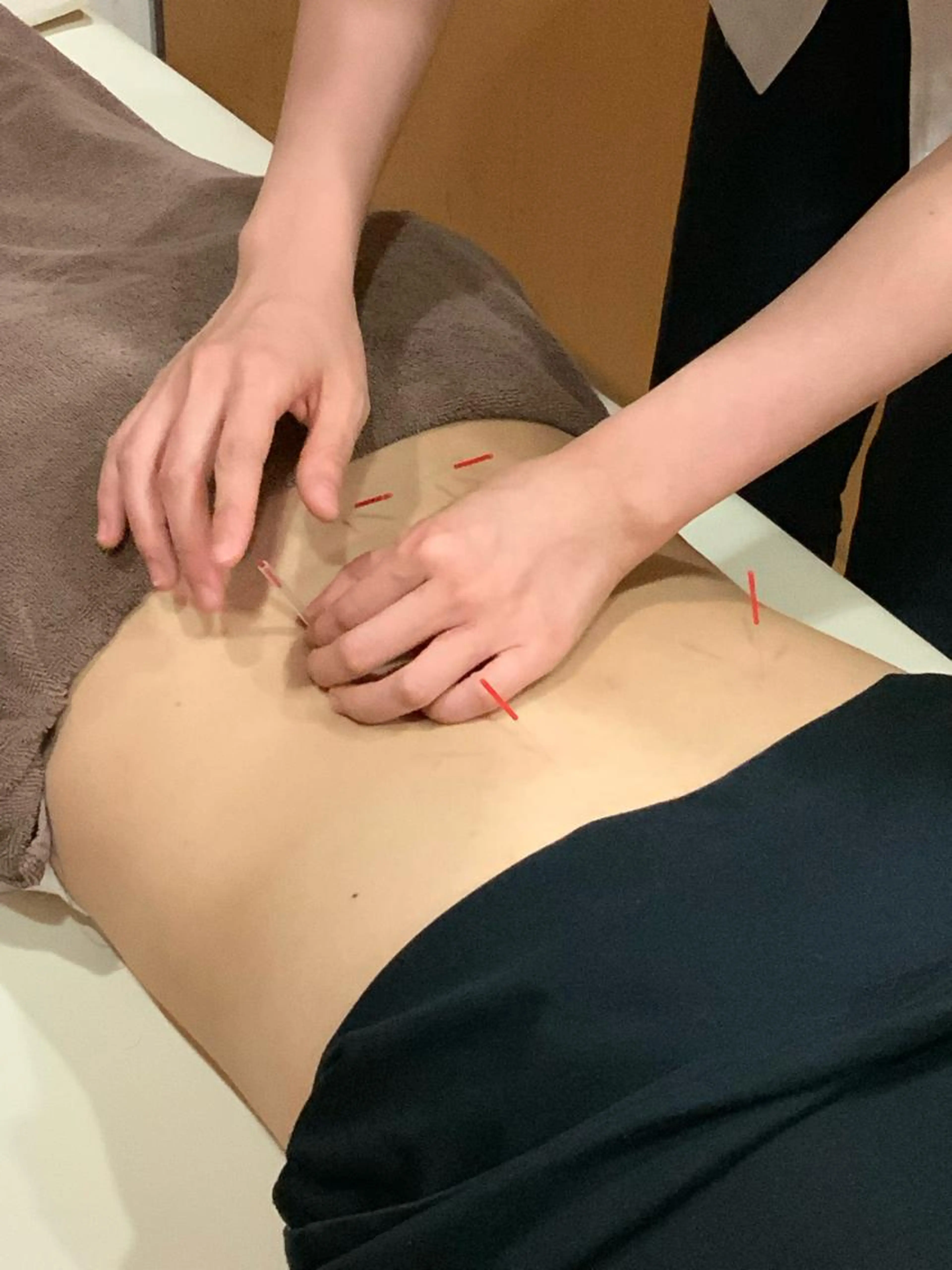 鍼灸《肩こり,腰痛,頭痛》の写真