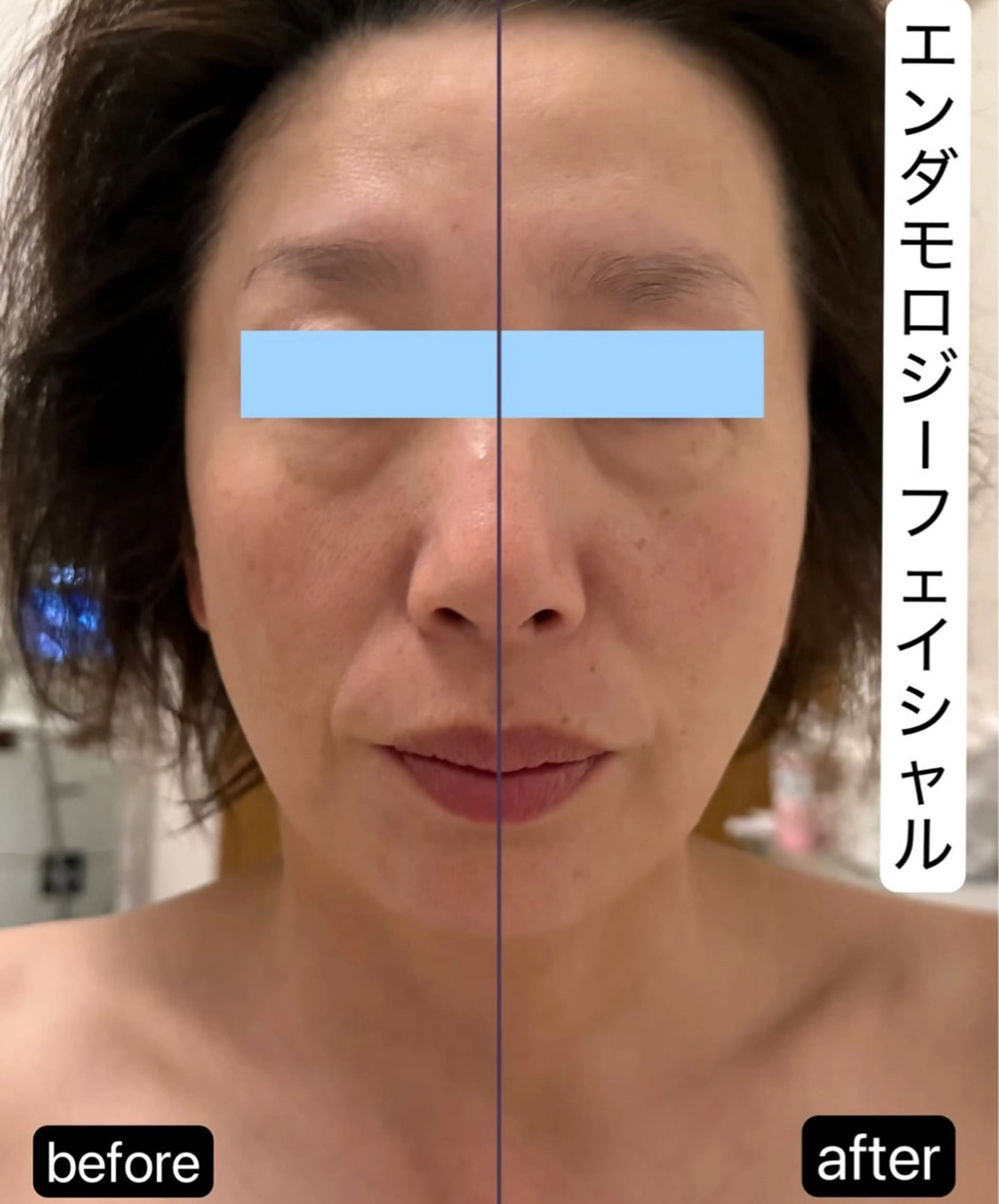 Binosu所属・エンダモロジー BINOSU平野のエステ・リラクイメージ