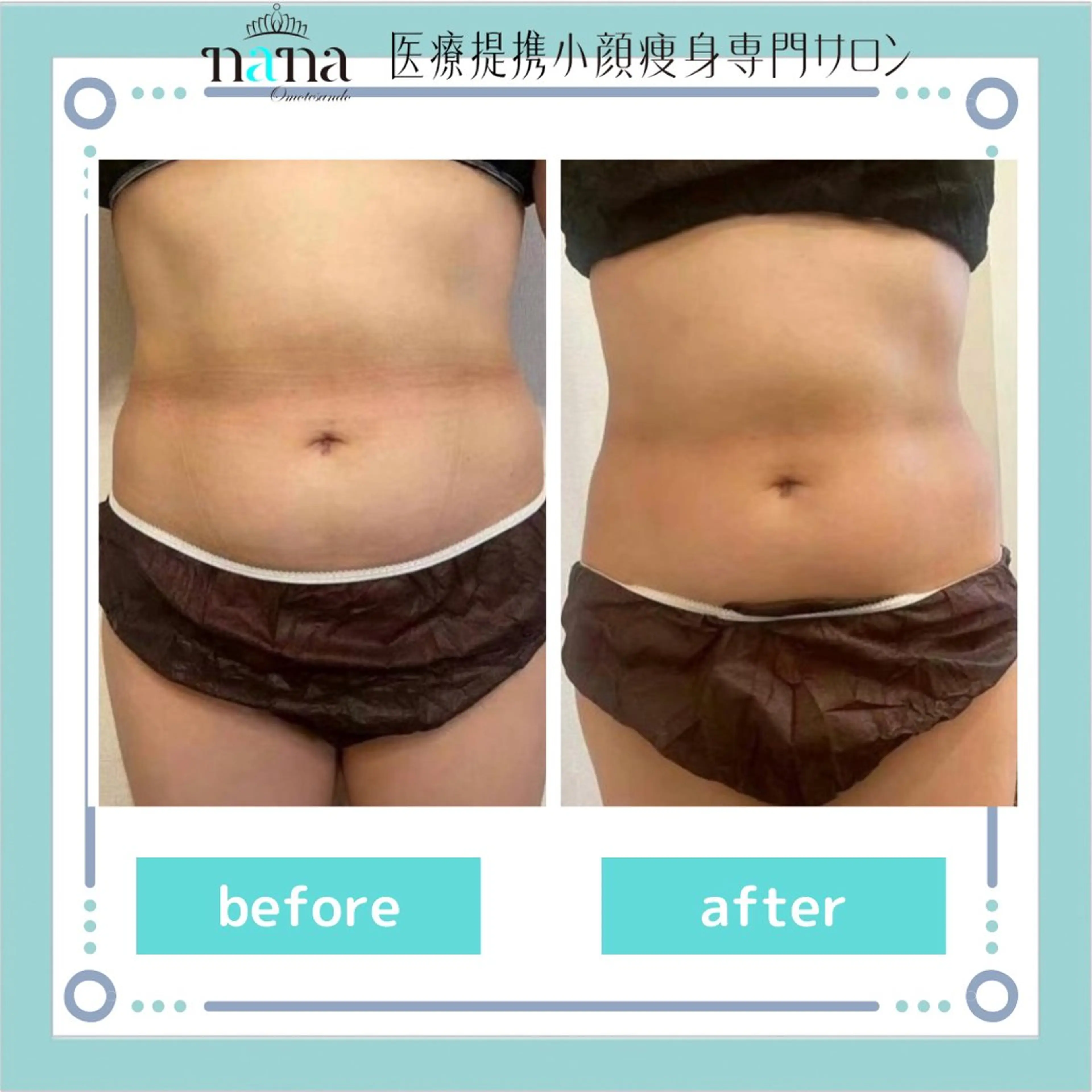 小顔痩身インディバ Nana表参道のエステ・リラクイメージ