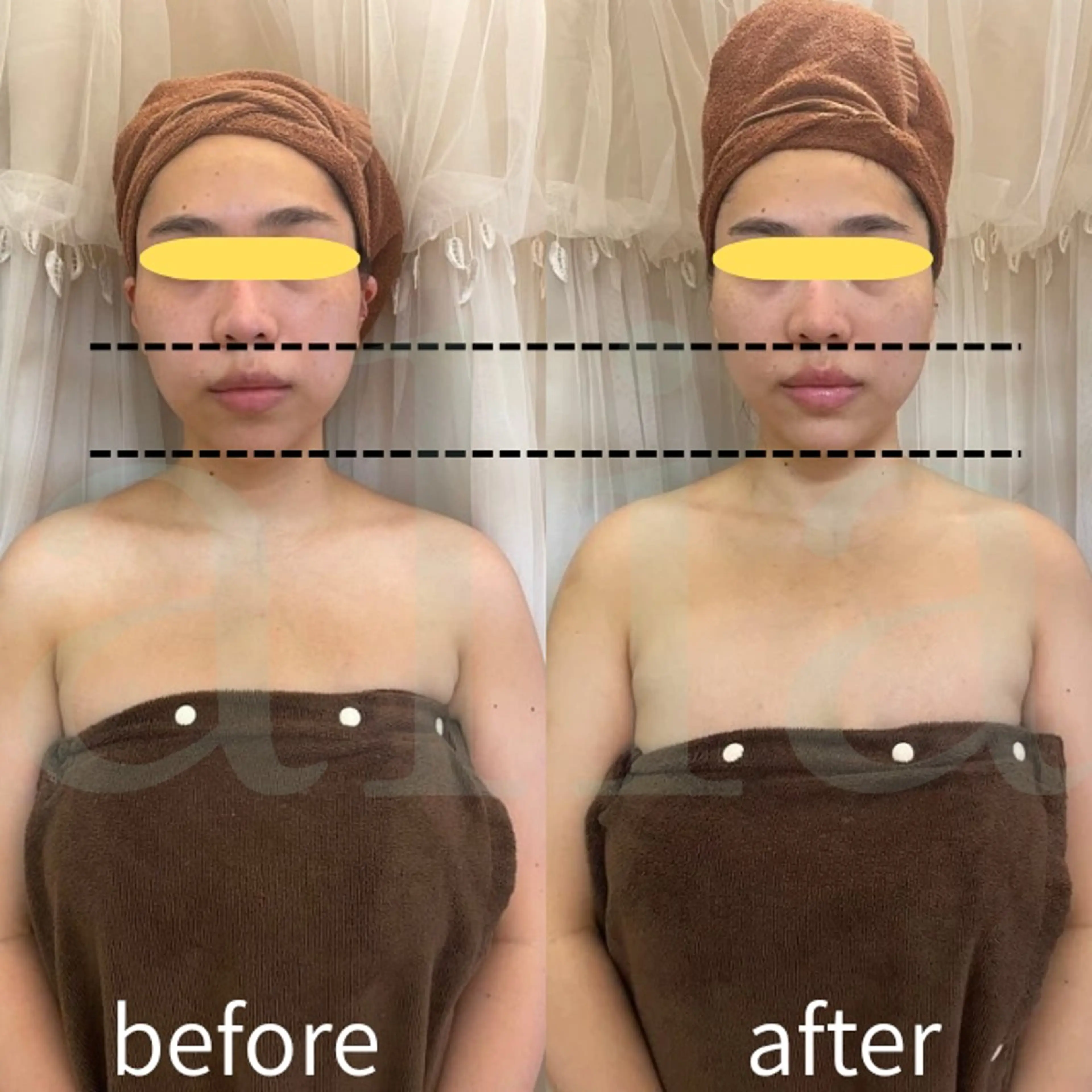 エステ aliaハイフ&水光ジェットサロン所属・aliaハーブ水光店 エステティシャン募集のエステ・リラクイメージ