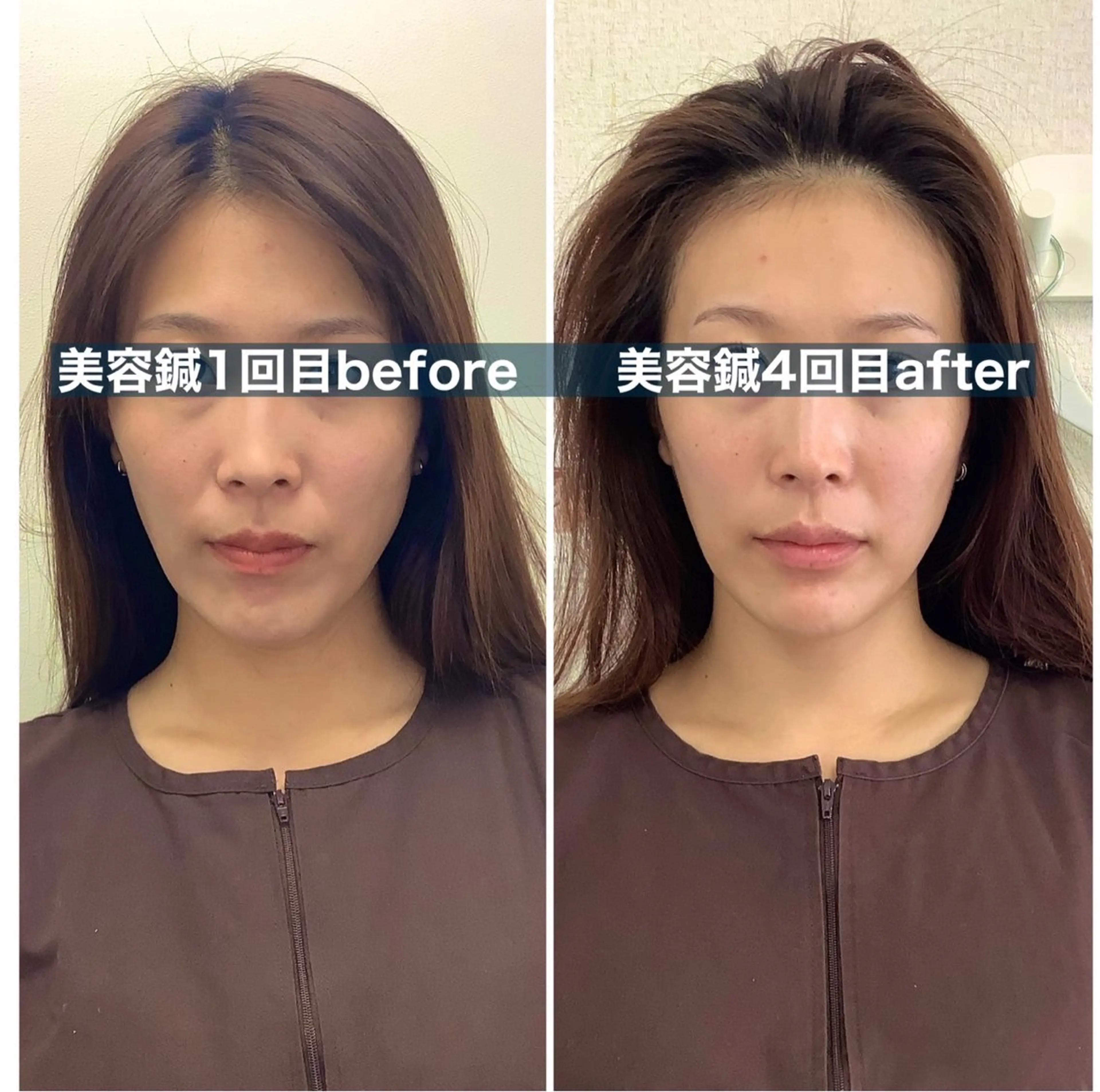 hari salon de off　美容鍼灸×小顔整体【ハリサロンドオフ】所属・美容鍼×小顔整体🤍 ishibashiのエステ・リラクイメージ