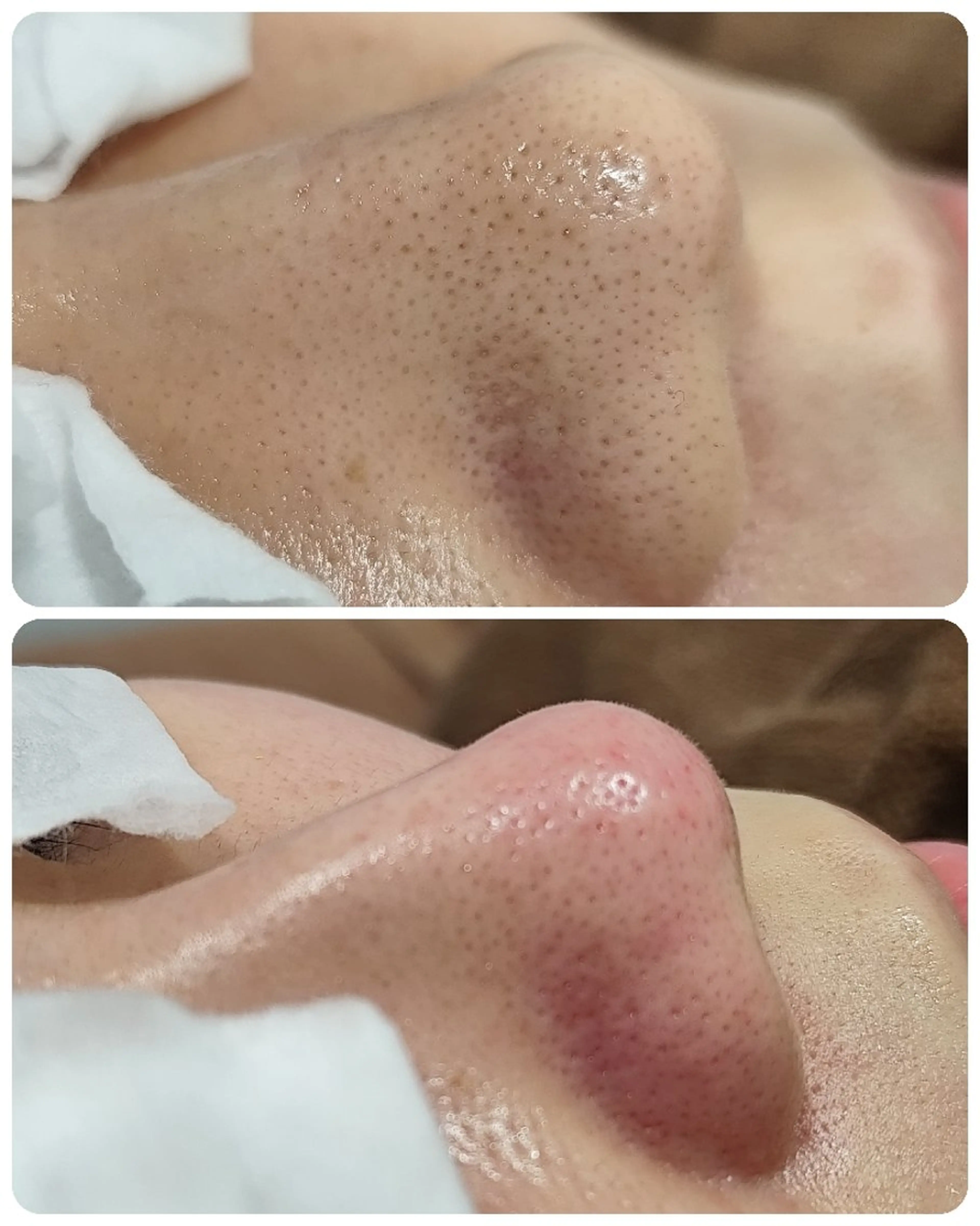 美肌脱毛サロン つるりと御殿場店所属・美肌脱毛サロン つるりとのその他イメージ