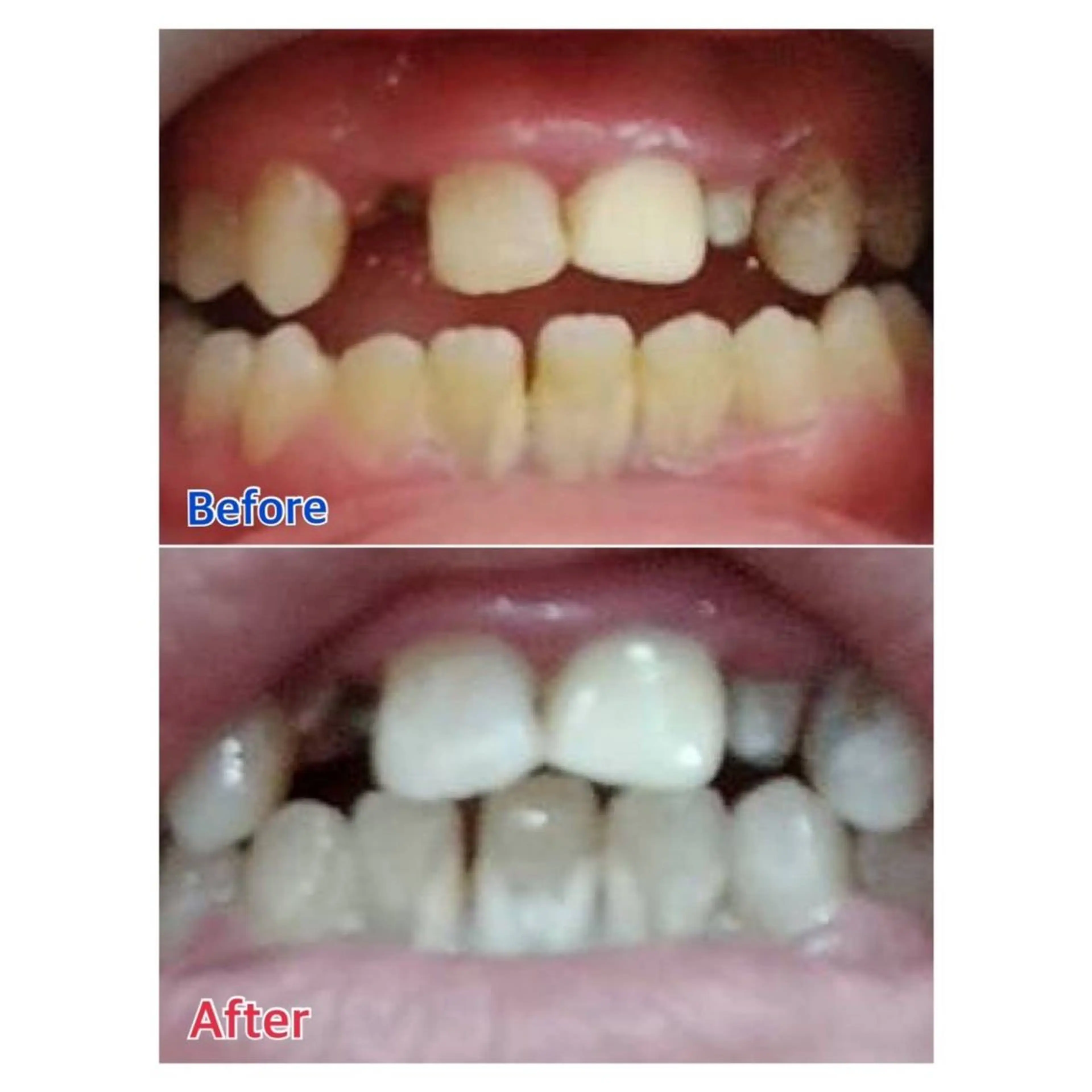 MBEAUTYSALON 千葉店・京成大久保所属・Melty 輝のその他イメージ