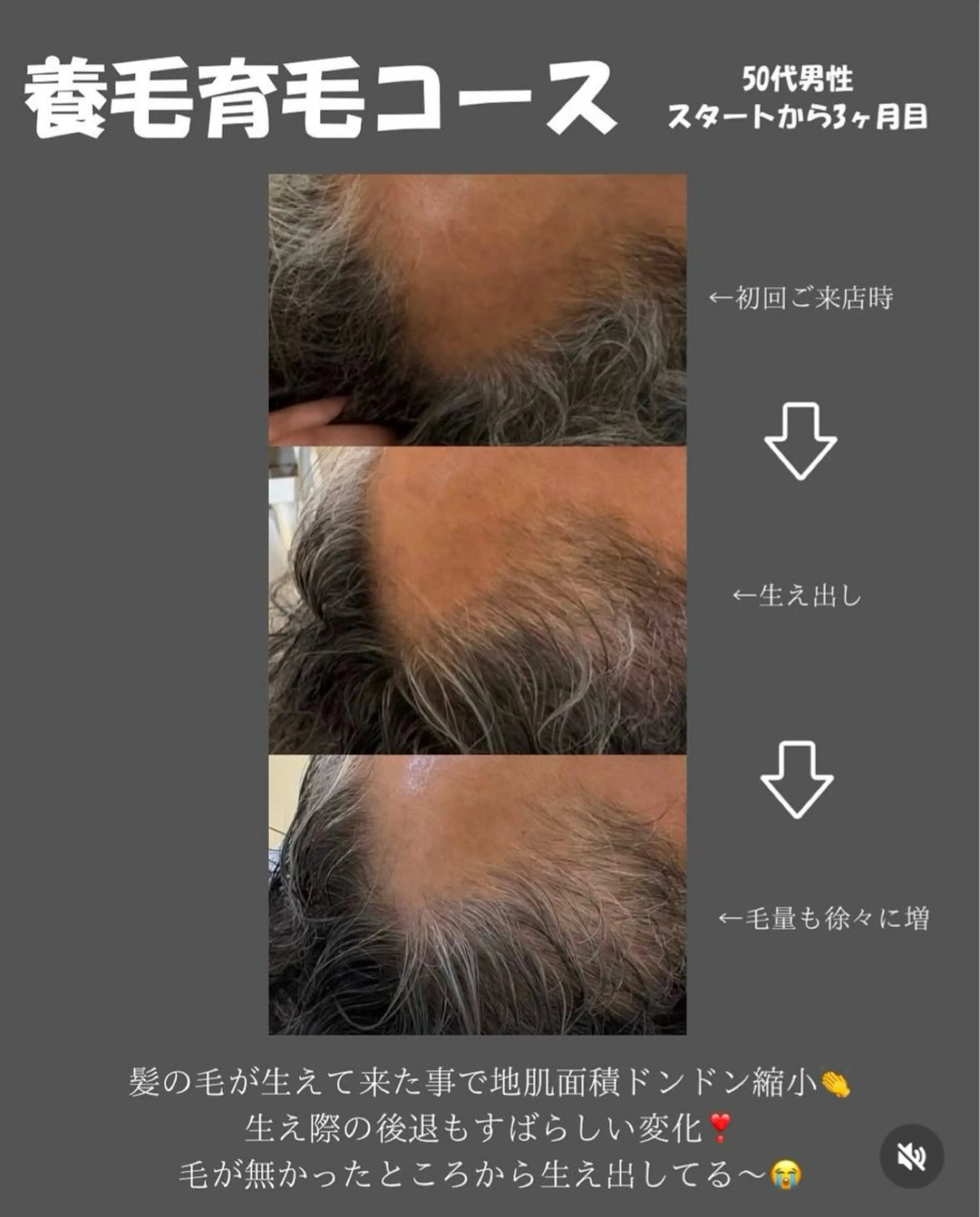 育毛スカルプジェットトリートメント【育毛・白髪・養毛】の写真