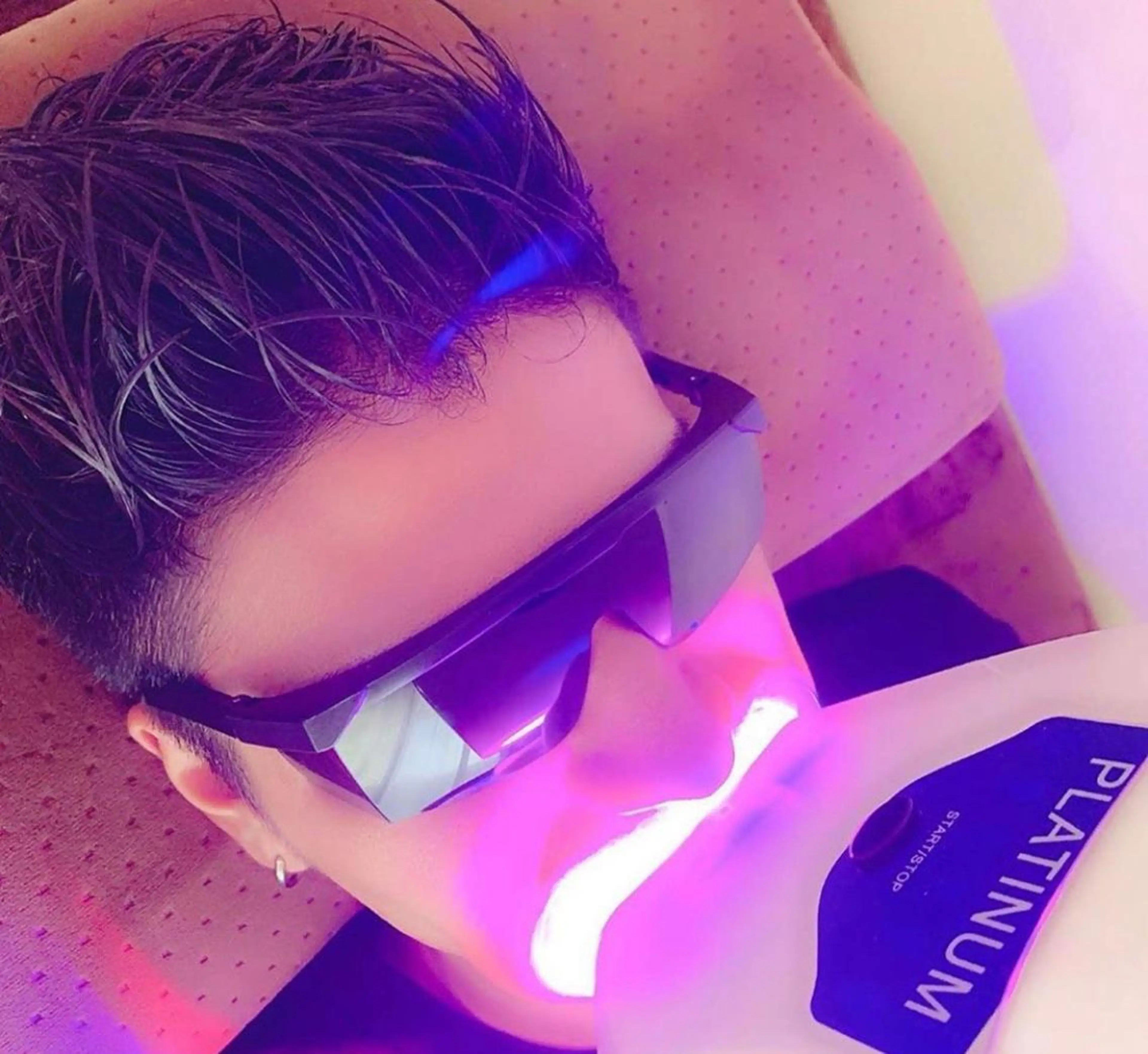 🌻当日予約限定!¥2900ハイパワー💎セルフホワイトニング  💎(10×3照射)の写真