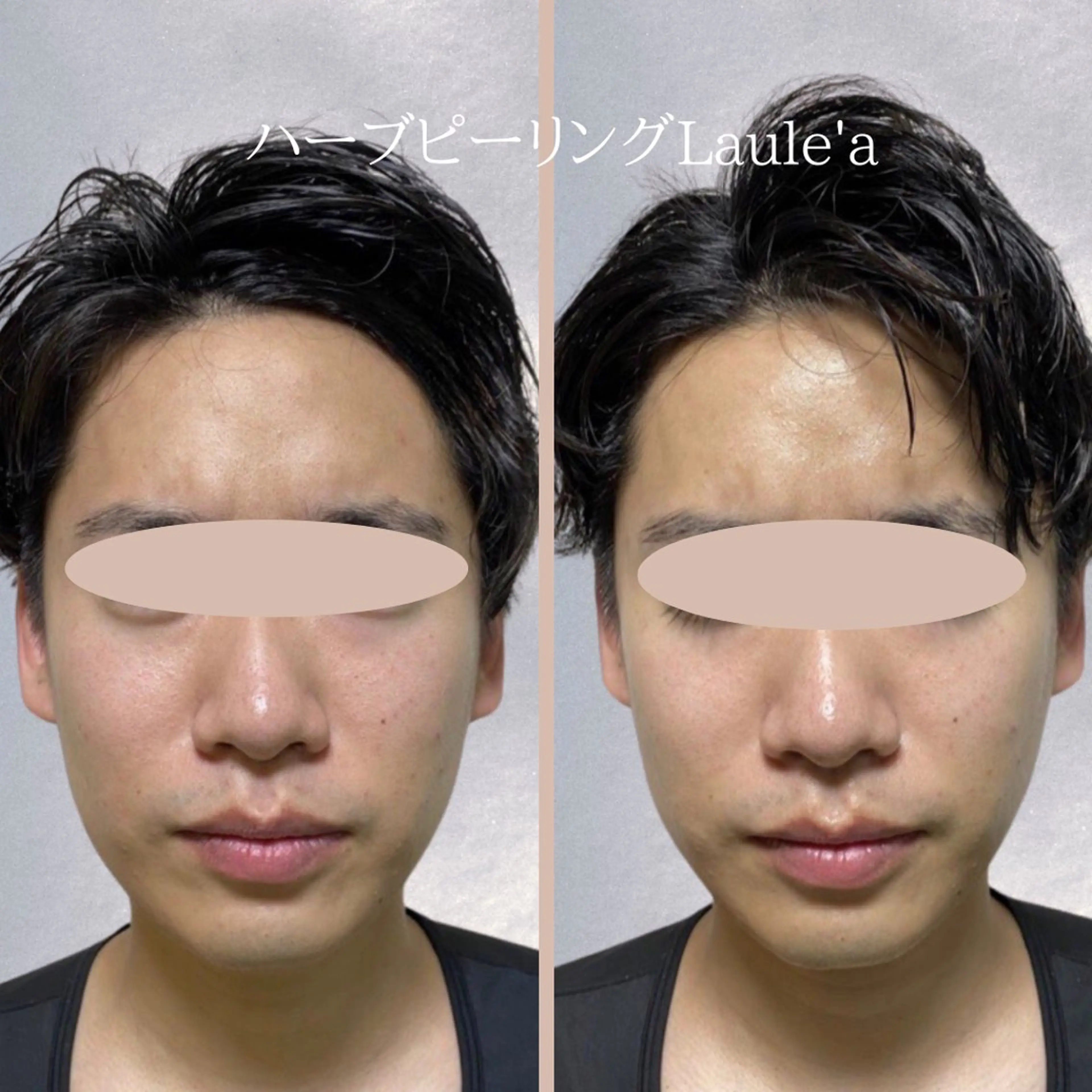 痩身/腸もみ/ ヘッドスパ/リンパのエステ・リラクイメージ