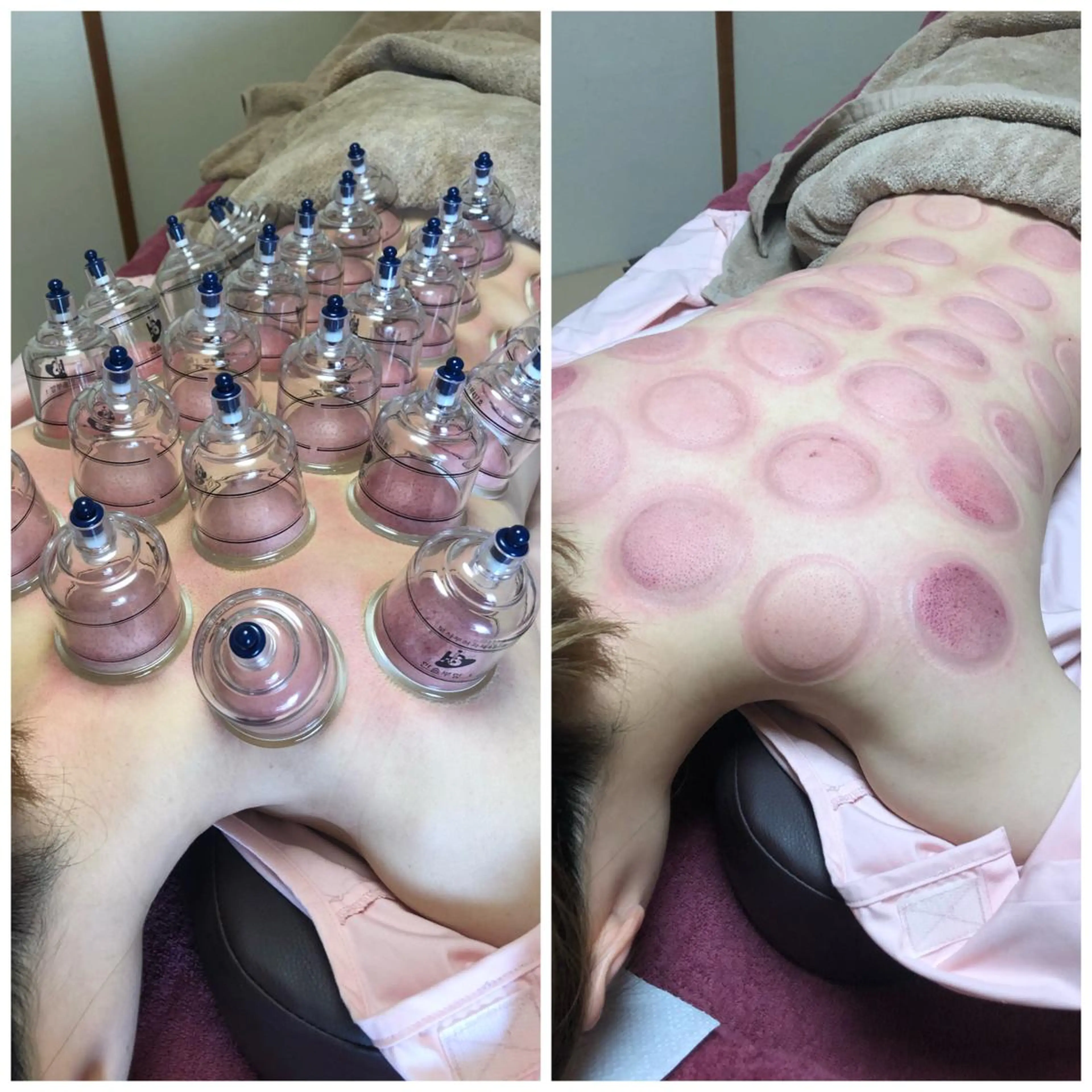 その他 美容鍼灸女性専用 りんご鍼灸治療院のその他イメージ