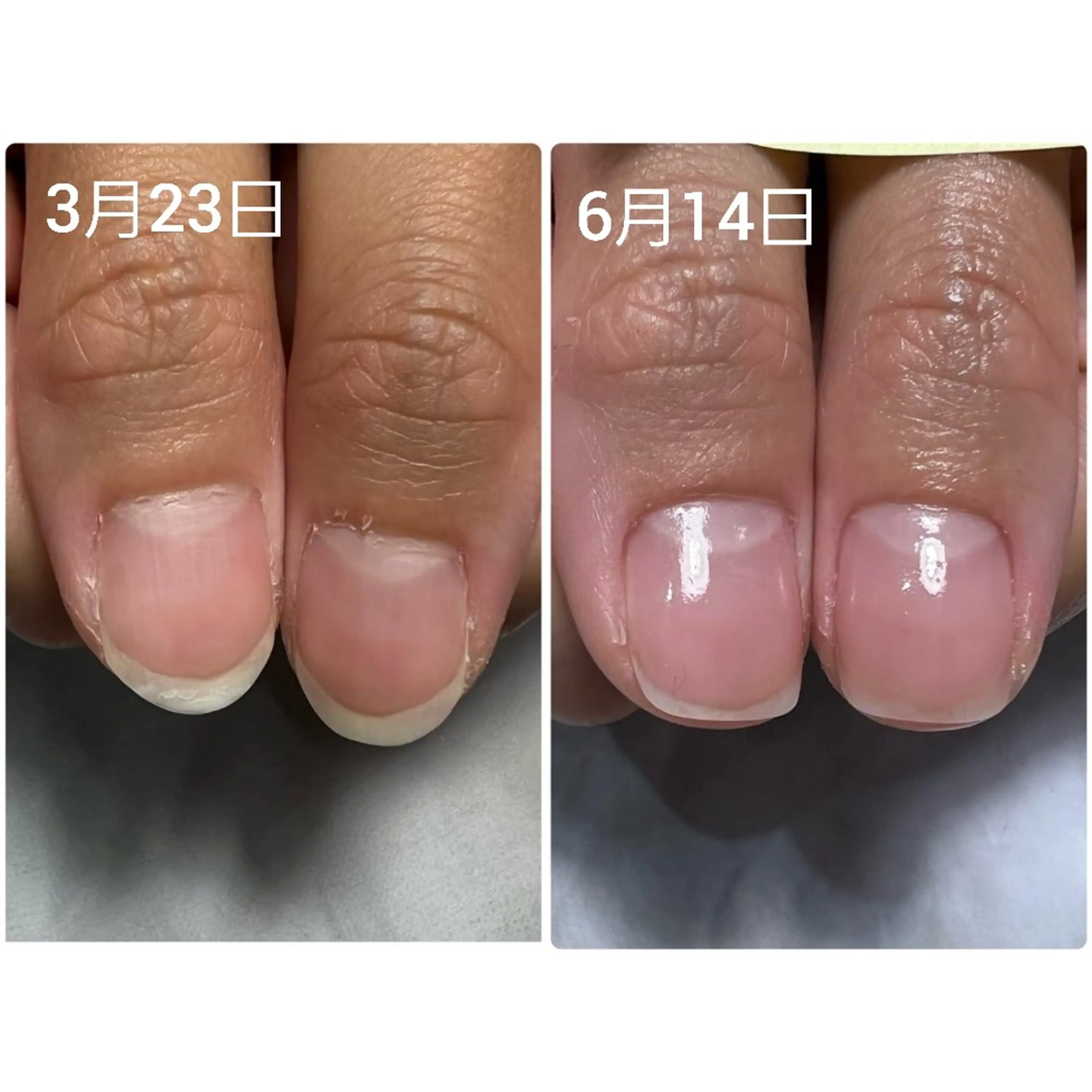 ネイル ジェルネイル ハンドケア AKT NAIL所属・AKT Beauty ドライヘッドスパのネイルデザイン